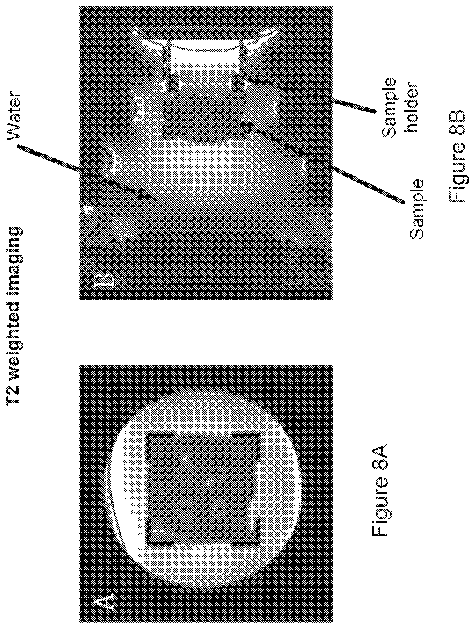 Patent US12396653 Figure 8 – MRI-based feedback control of ultrasound based mechanical fractionation of biological tissue