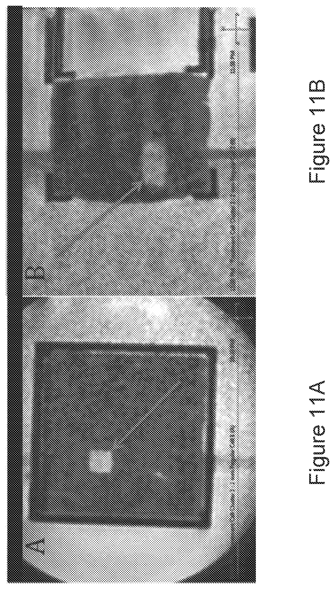 Patent US12396653 Figure 11 – MRI-based feedback control of ultrasound based mechanical fractionation of biological tissue