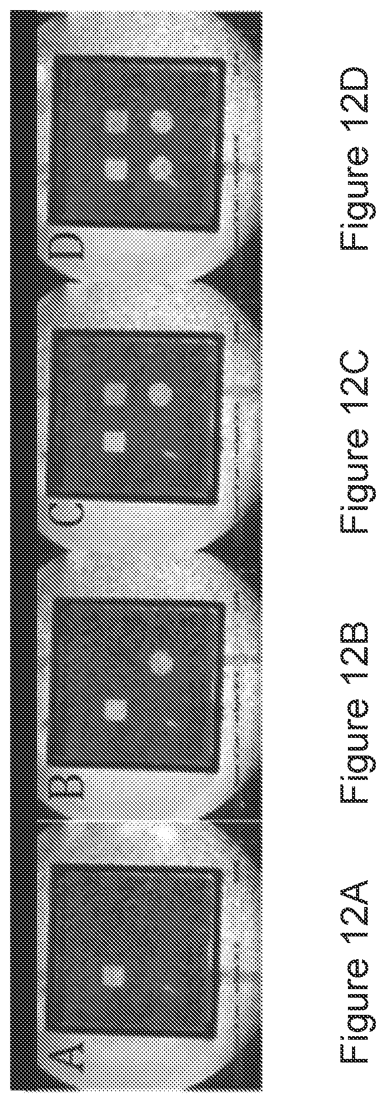 Patent US12396653 Figure 12 – MRI-based feedback control of ultrasound based mechanical fractionation of biological tissue