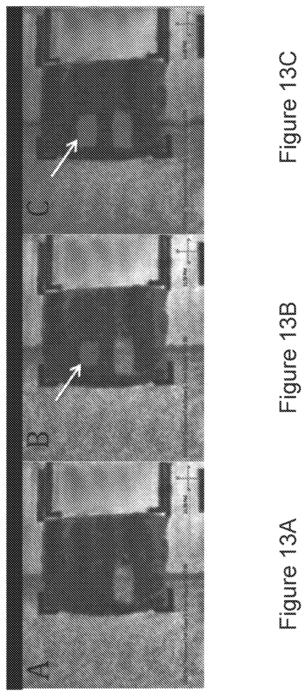 Patent US12396653 Figure 13 – MRI-based feedback control of ultrasound based mechanical fractionation of biological tissue