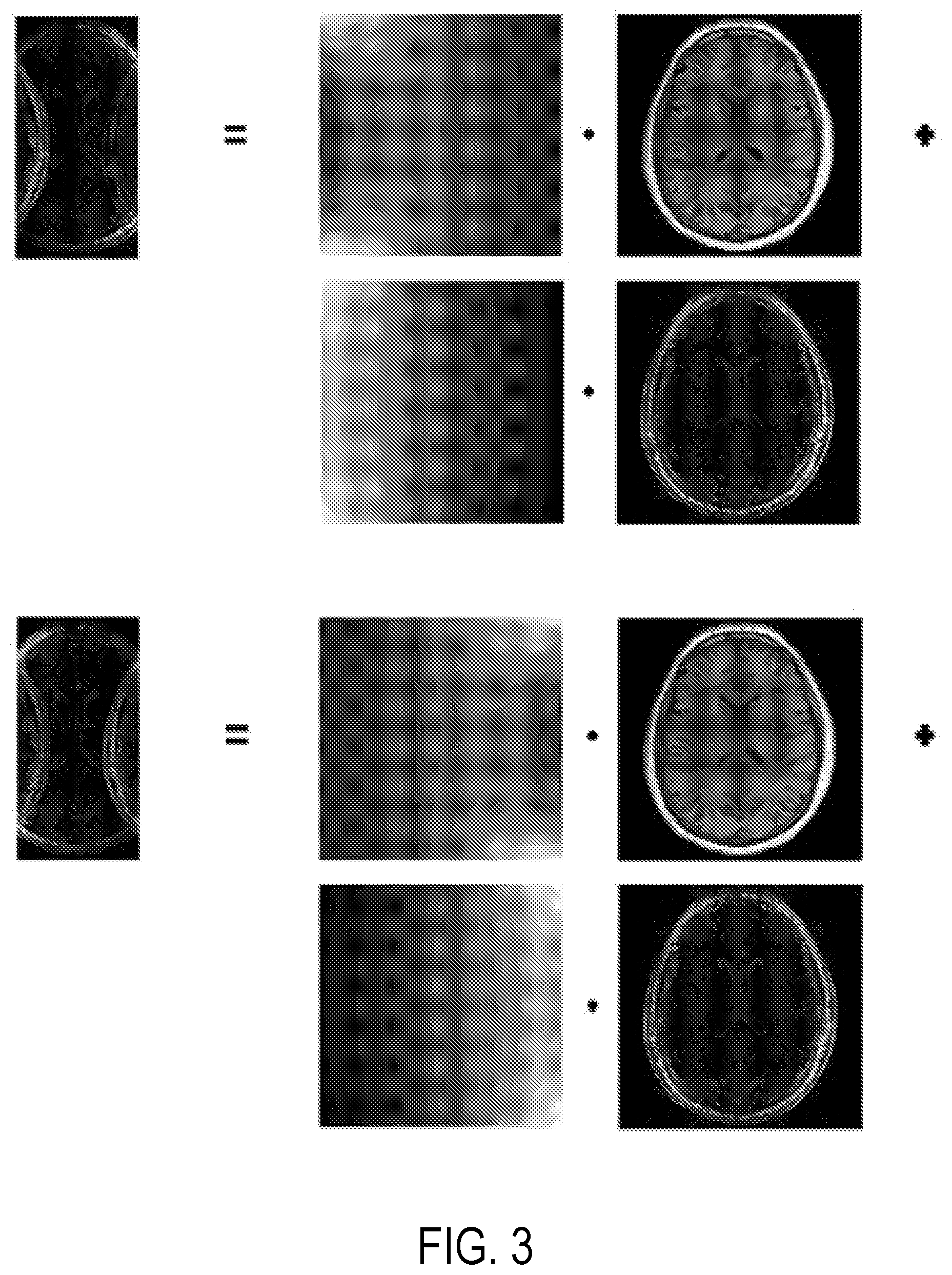Patent US12396654 Figure 3 – Reconstruction augmentation by constraining with intensity gradients in MRI