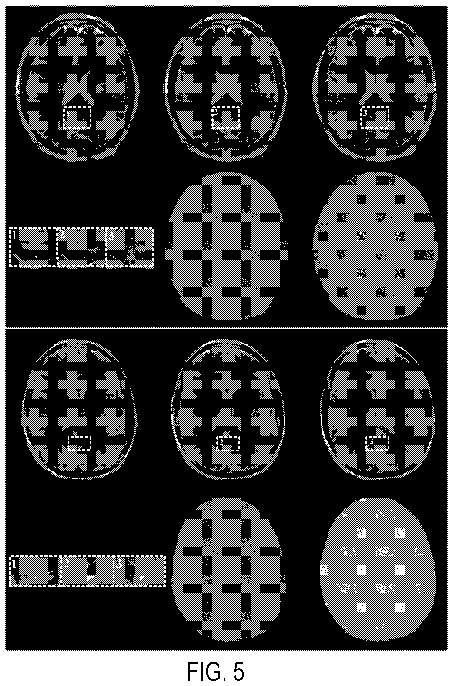 Patent US12396654 Figure 5 – Reconstruction augmentation by constraining with intensity gradients in MRI
