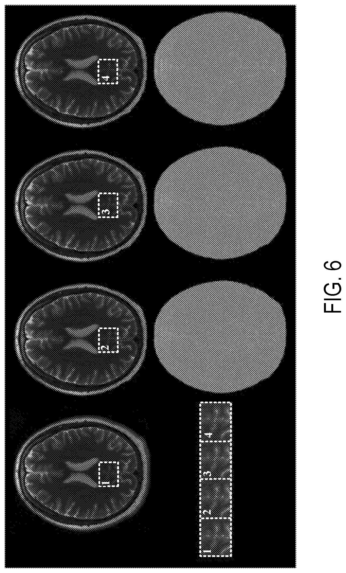 Patent US12396654 Figure 6 – Reconstruction augmentation by constraining with intensity gradients in MRI