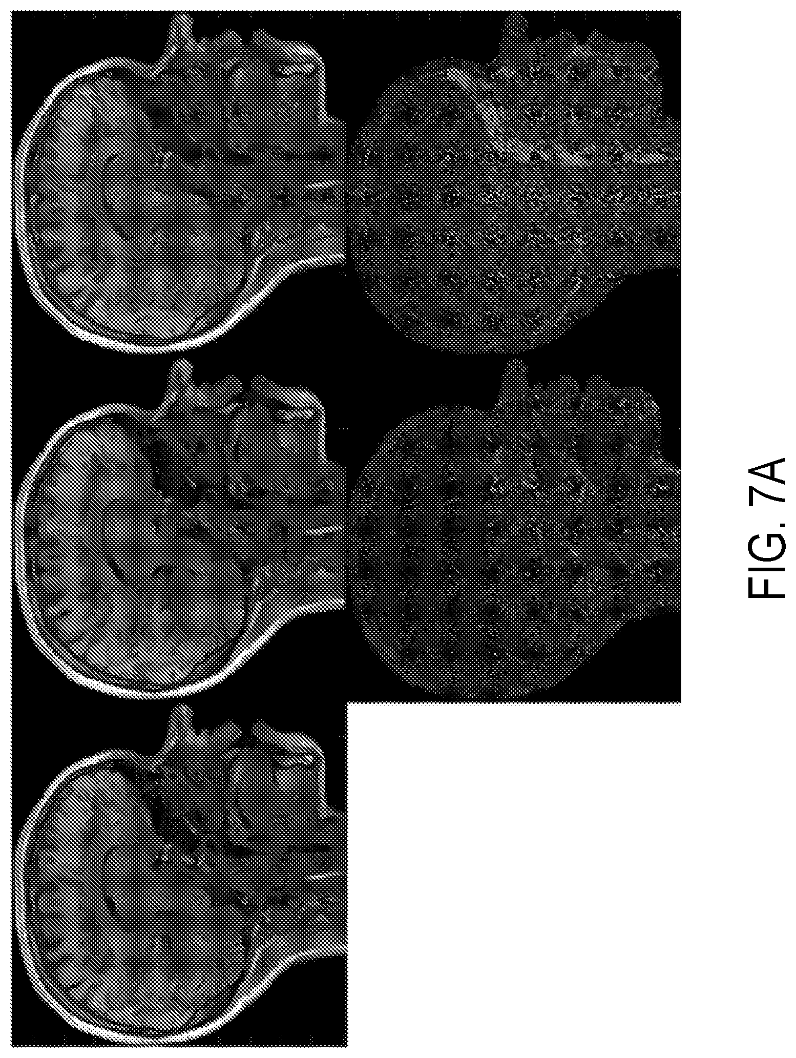 Patent US12396654 Figure 7 – Reconstruction augmentation by constraining with intensity gradients in MRI