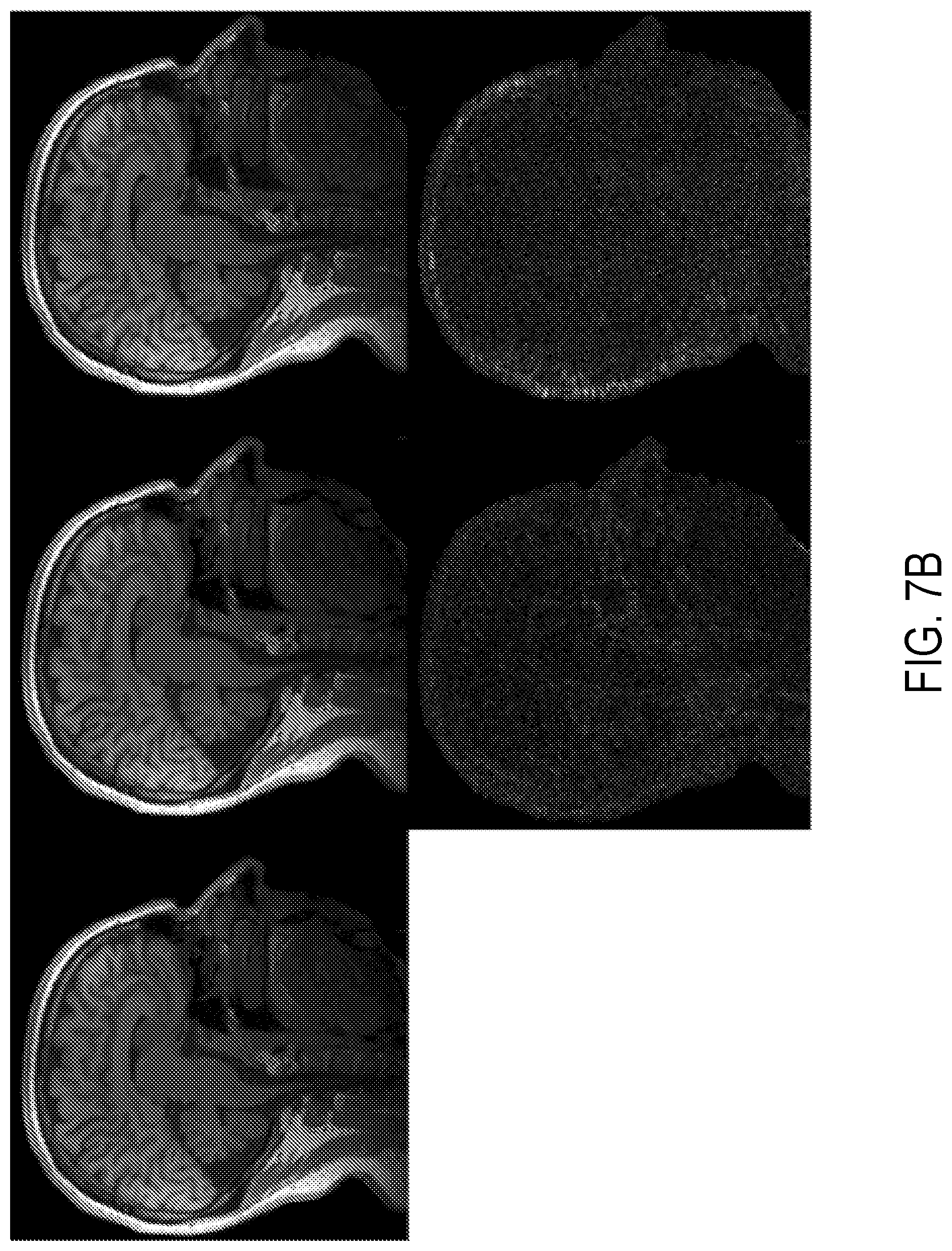 Patent US12396654 Figure 8 – Reconstruction augmentation by constraining with intensity gradients in MRI