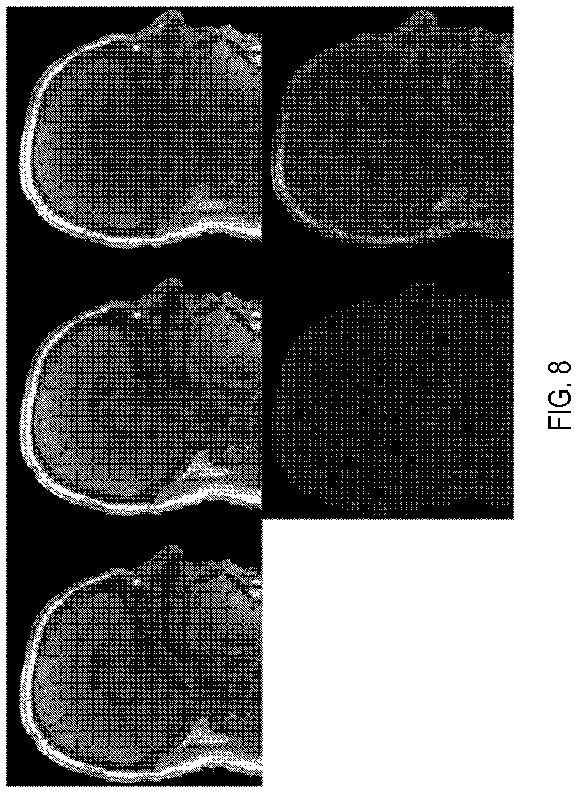Patent US12396654 Figure 9 – Reconstruction augmentation by constraining with intensity gradients in MRI