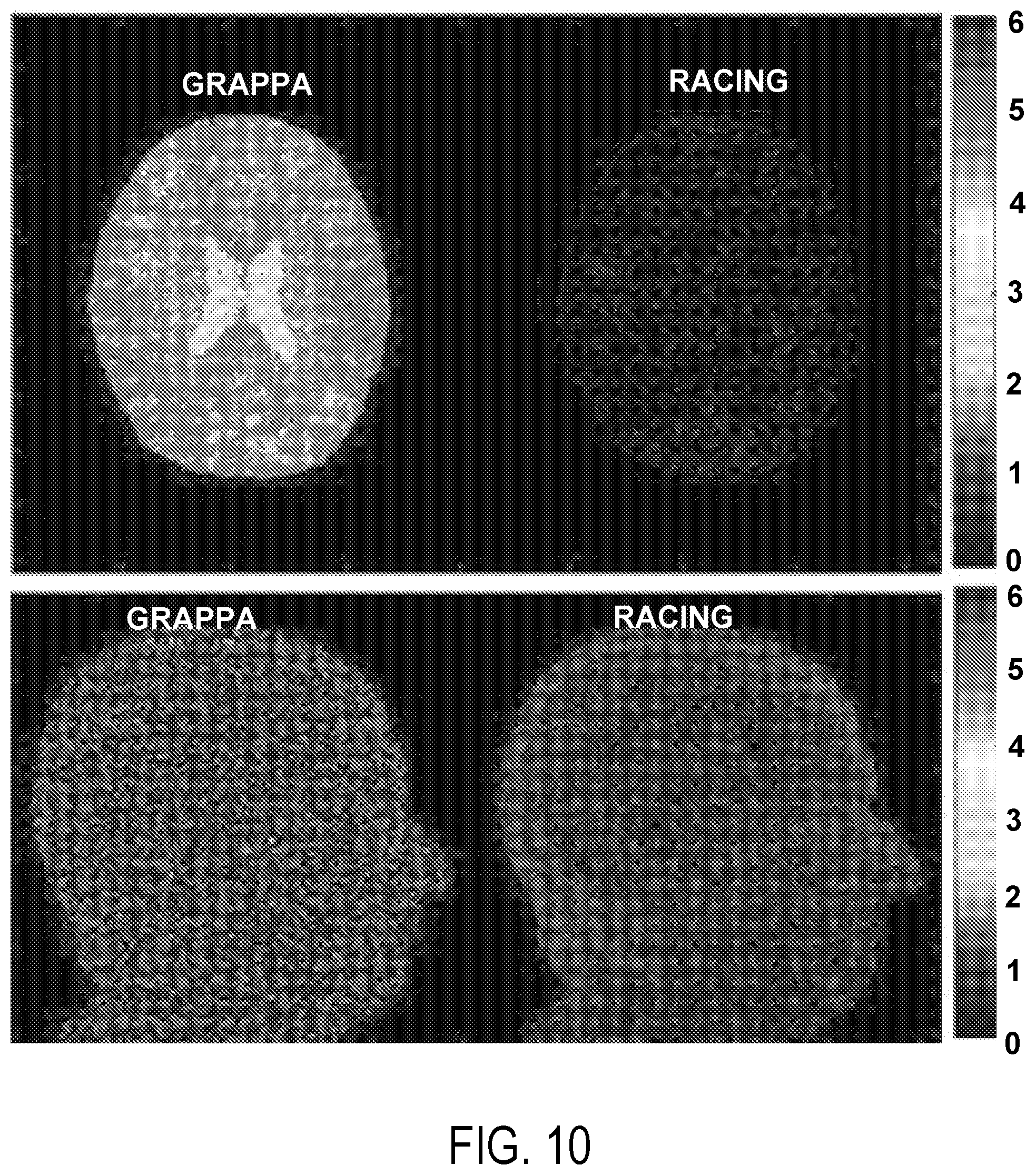 Patent US12396654 Figure 11 – Reconstruction augmentation by constraining with intensity gradients in MRI