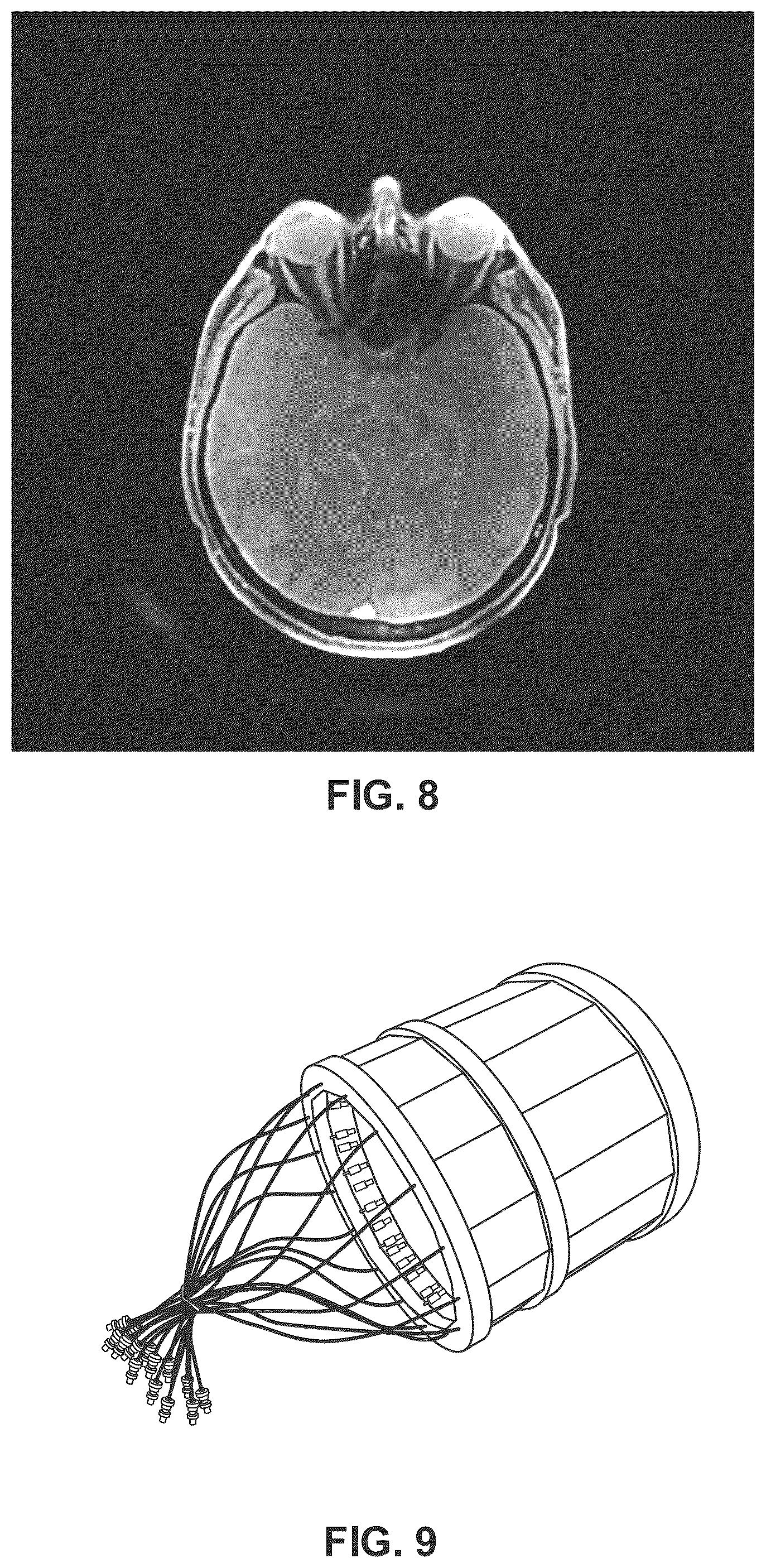 Patent US12396655 Figure 6 – Robust and computationally efficient missing point and phase estimation for FID sequences