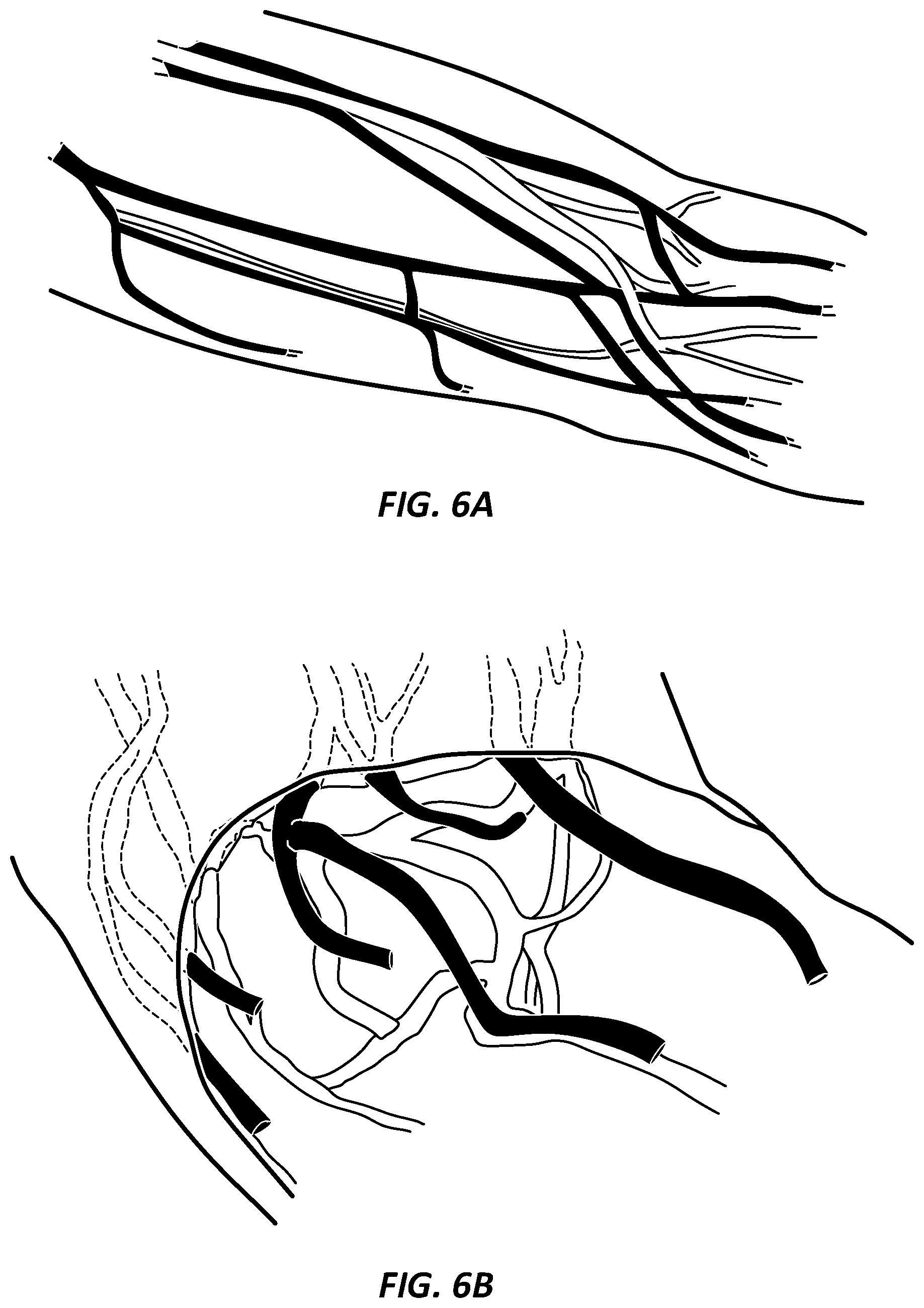 Patent US12396656 Figure 6 – Systems and methods for visualizing anatomy, locating medical devices, or placing medical devices