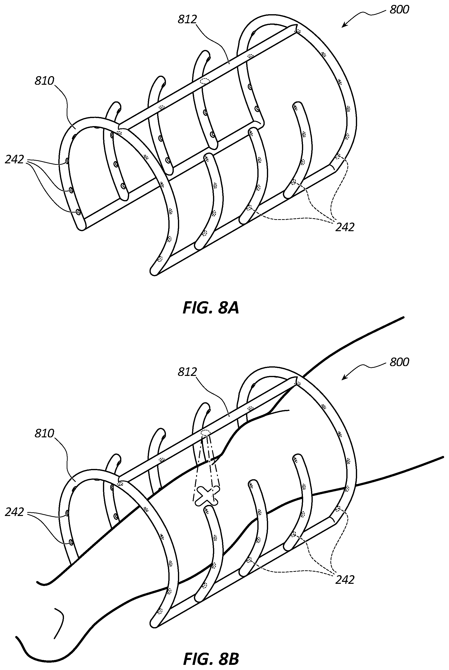 Patent US12396656 Figure 8 – Systems and methods for visualizing anatomy, locating medical devices, or placing medical devices
