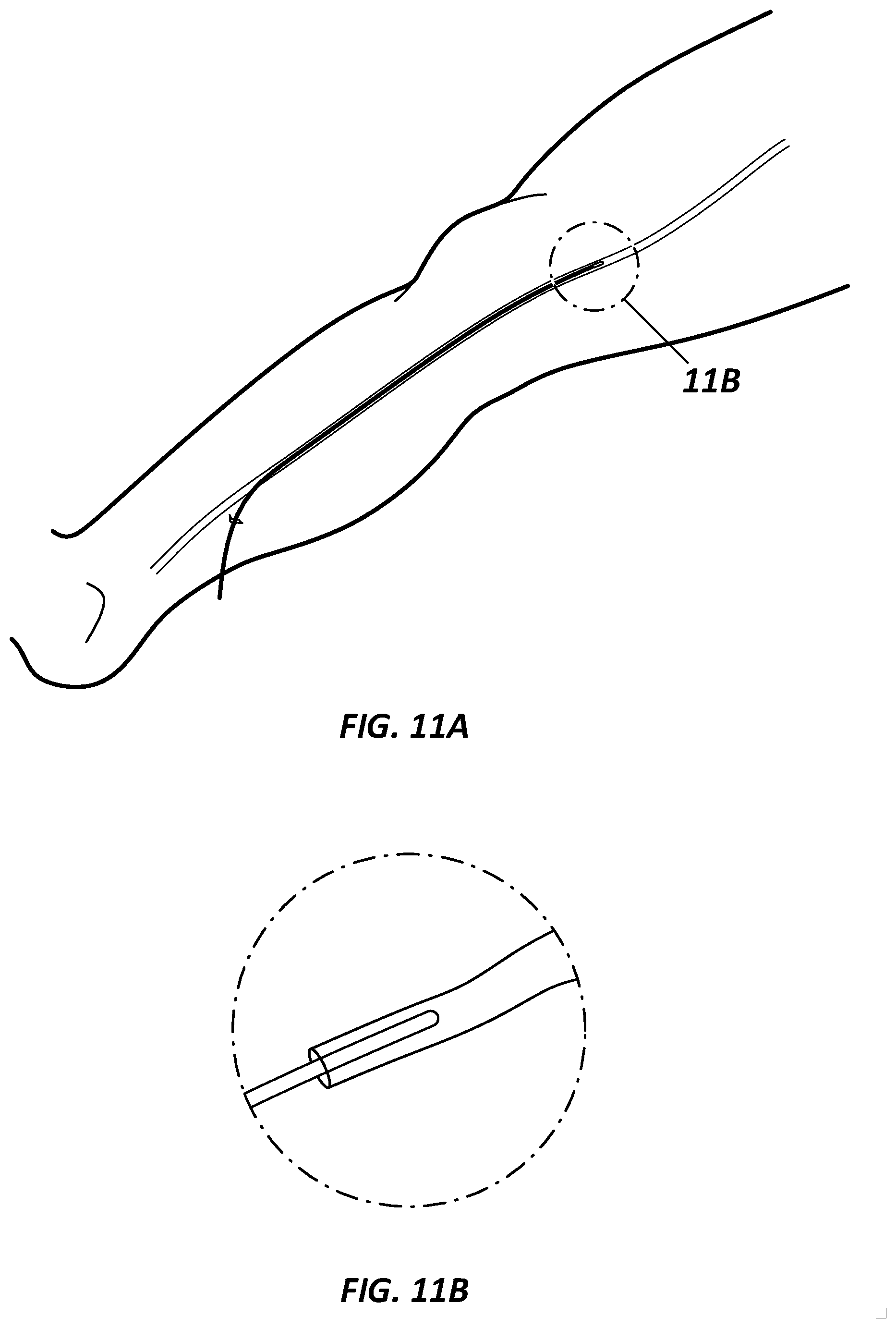 Patent US12396656 Figure 11 – Systems and methods for visualizing anatomy, locating medical devices, or placing medical devices
