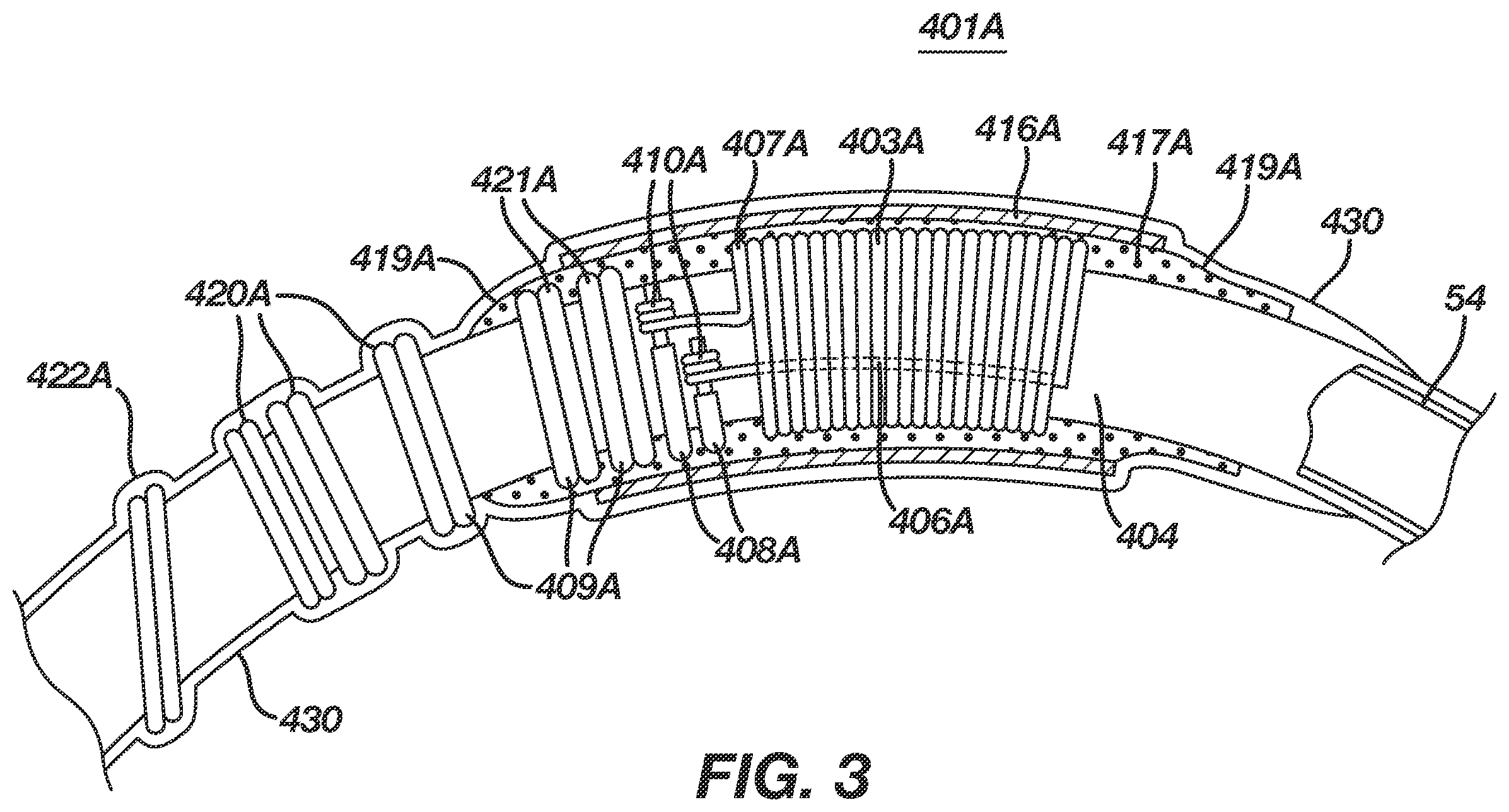 Patent US12396657 Figure 3 – Non-linear single axis navigation sensor with strain relief