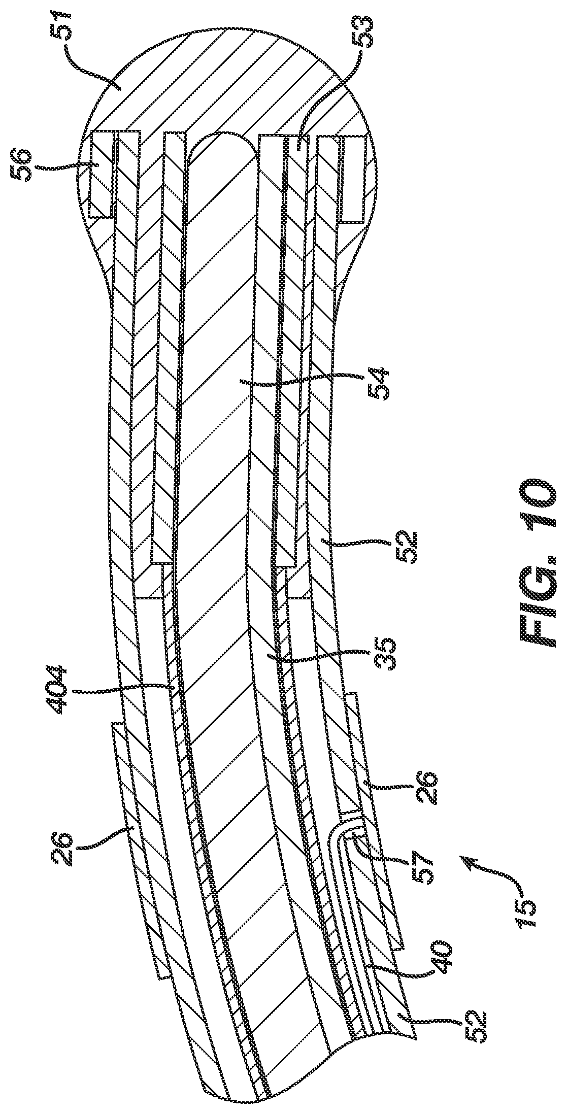 Patent US12396657 Figure 9 – Non-linear single axis navigation sensor with strain relief