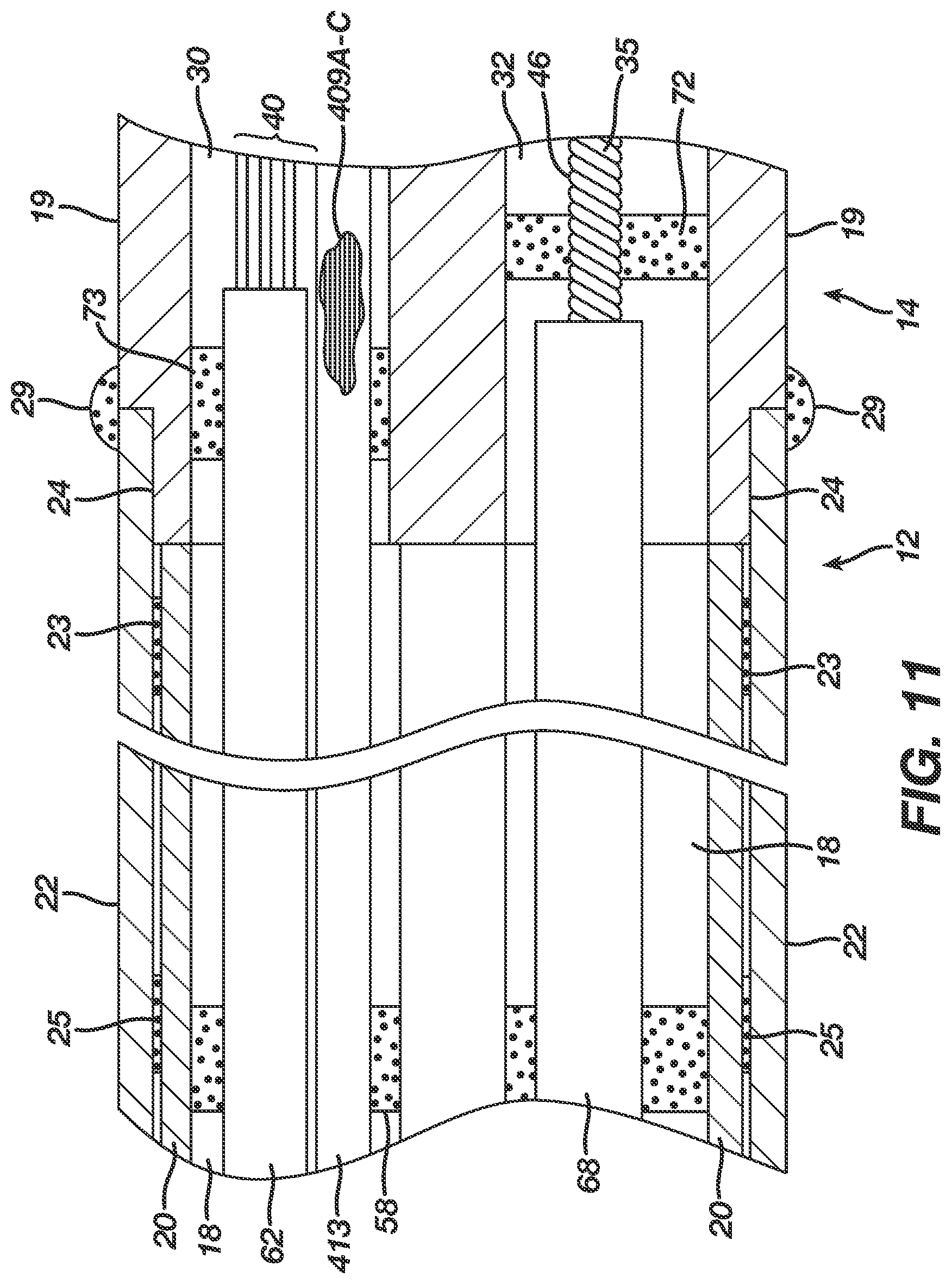 Patent US12396657 Figure 10 – Non-linear single axis navigation sensor with strain relief