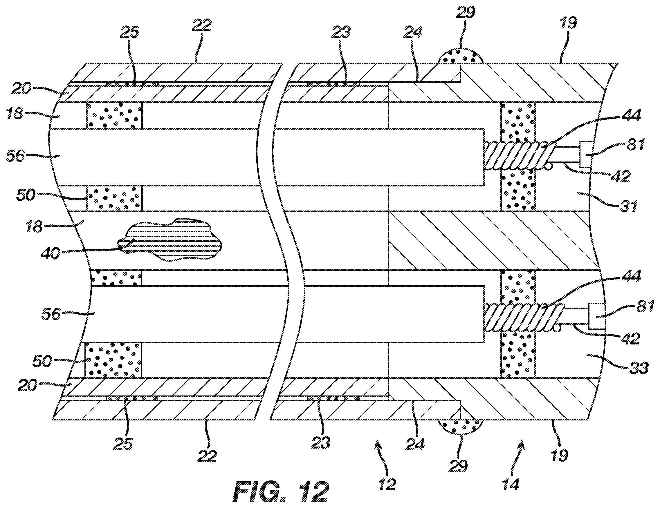 Patent US12396657 Figure 11 – Non-linear single axis navigation sensor with strain relief