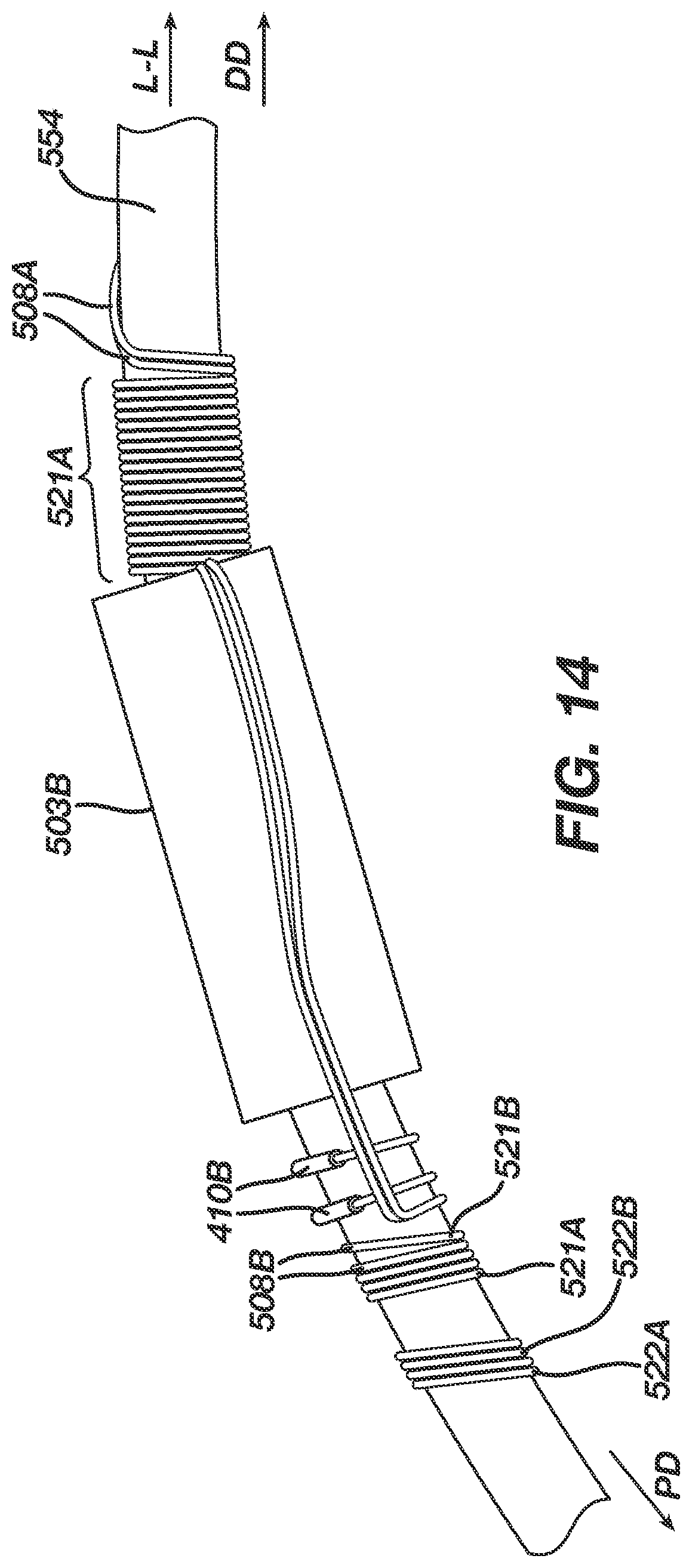 Patent US12396657 Figure 14 – Non-linear single axis navigation sensor with strain relief