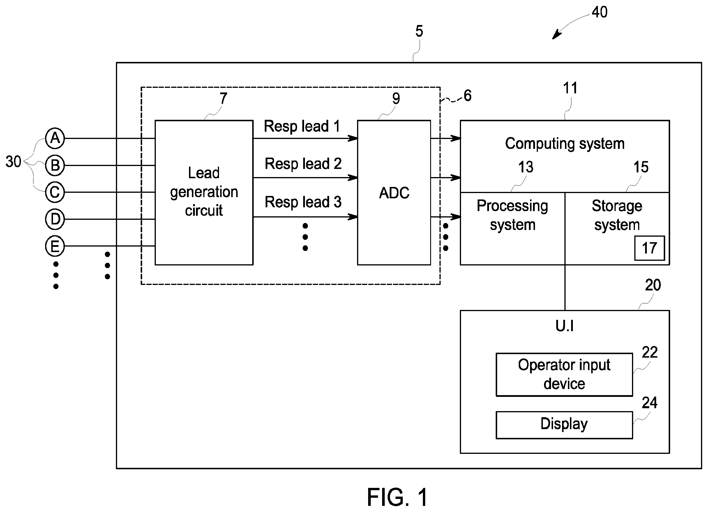 Patent US12396658 Figure 1 – System and method for apnea detection