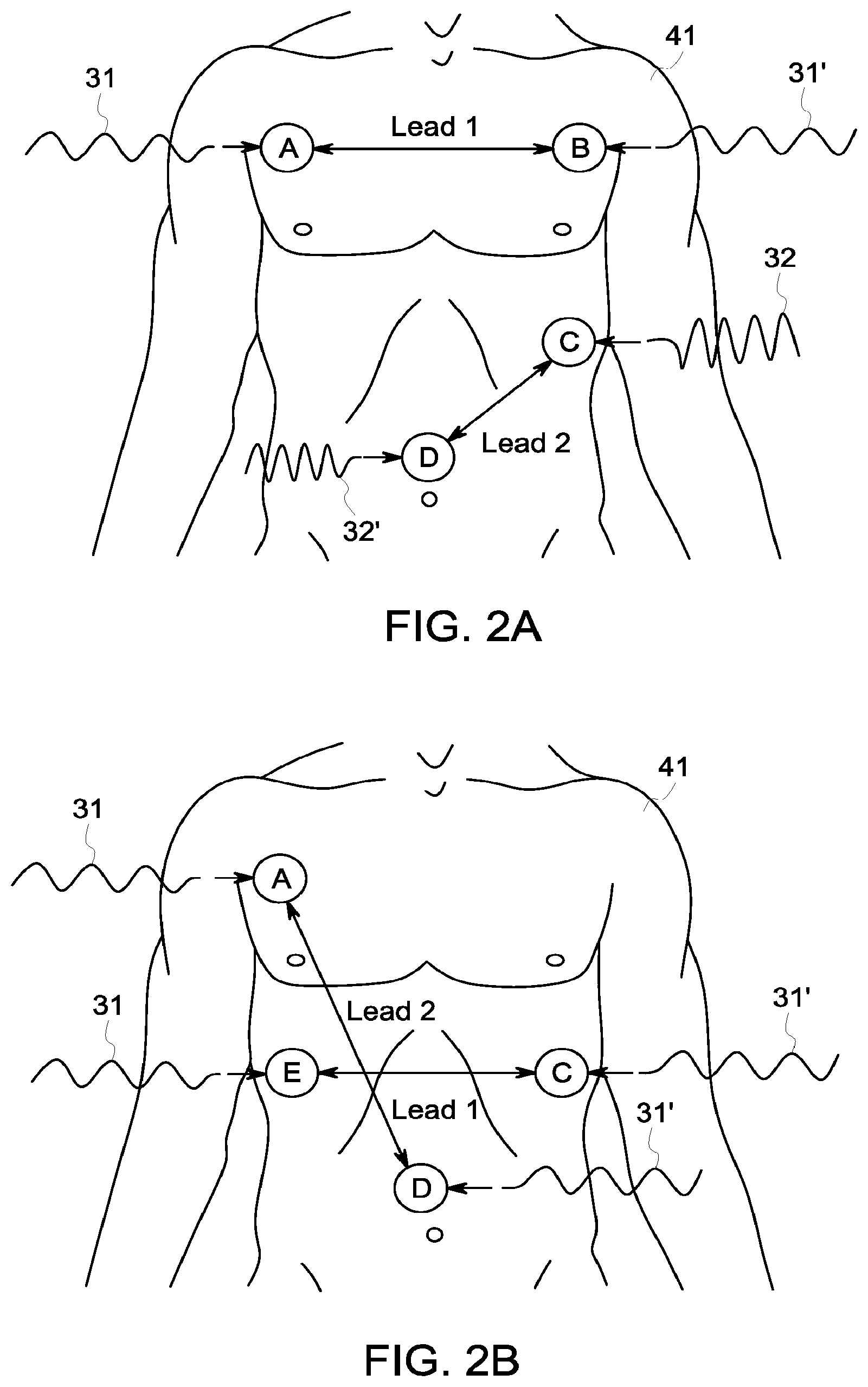 Patent US12396658 Figure 2 – System and method for apnea detection