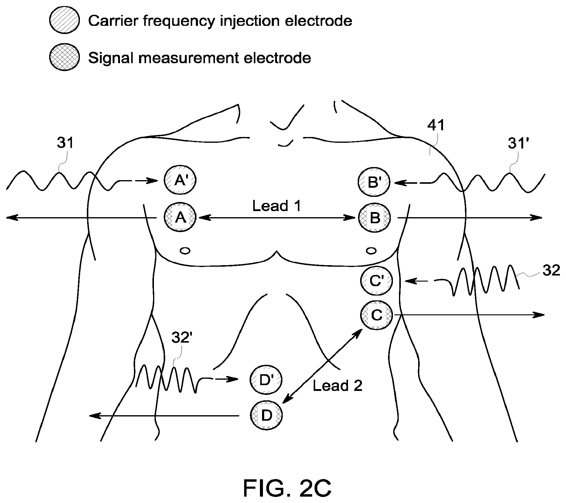 Patent US12396658 Figure 3 – System and method for apnea detection