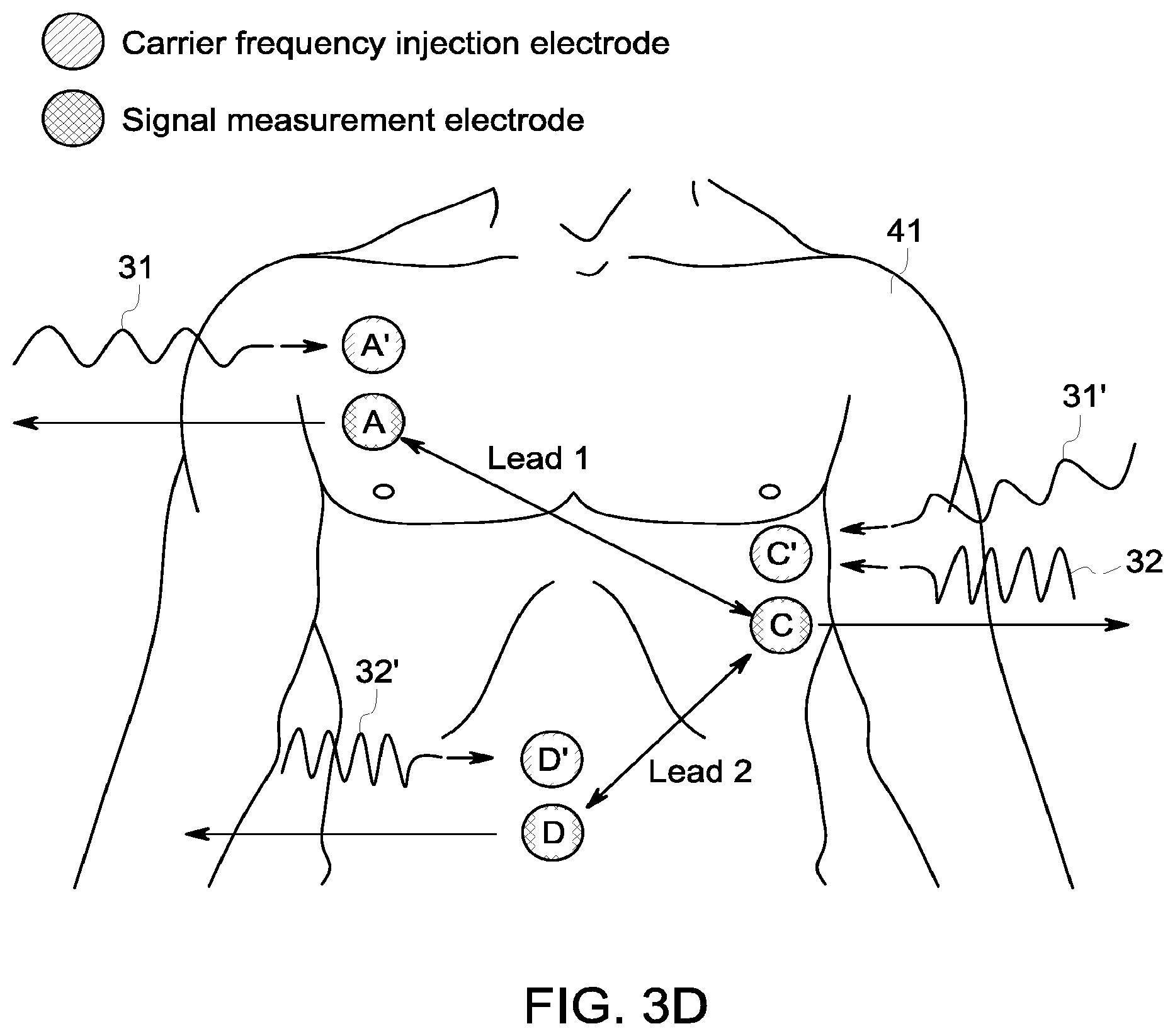 Patent US12396658 Figure 6 – System and method for apnea detection