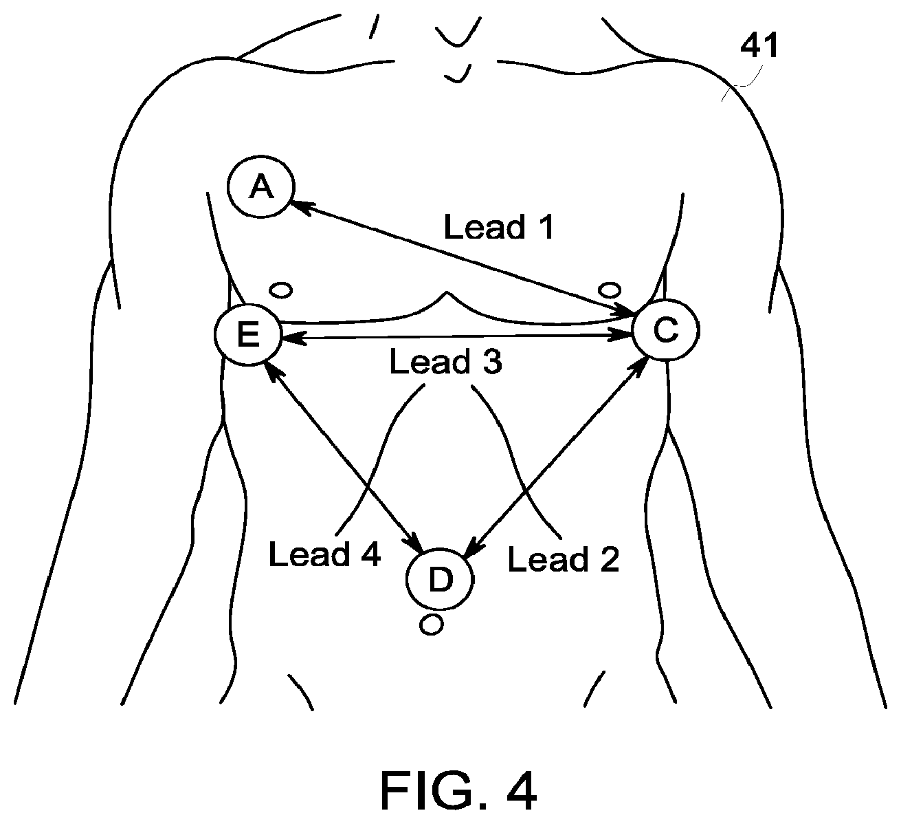 Patent US12396658 Figure 7 – System and method for apnea detection