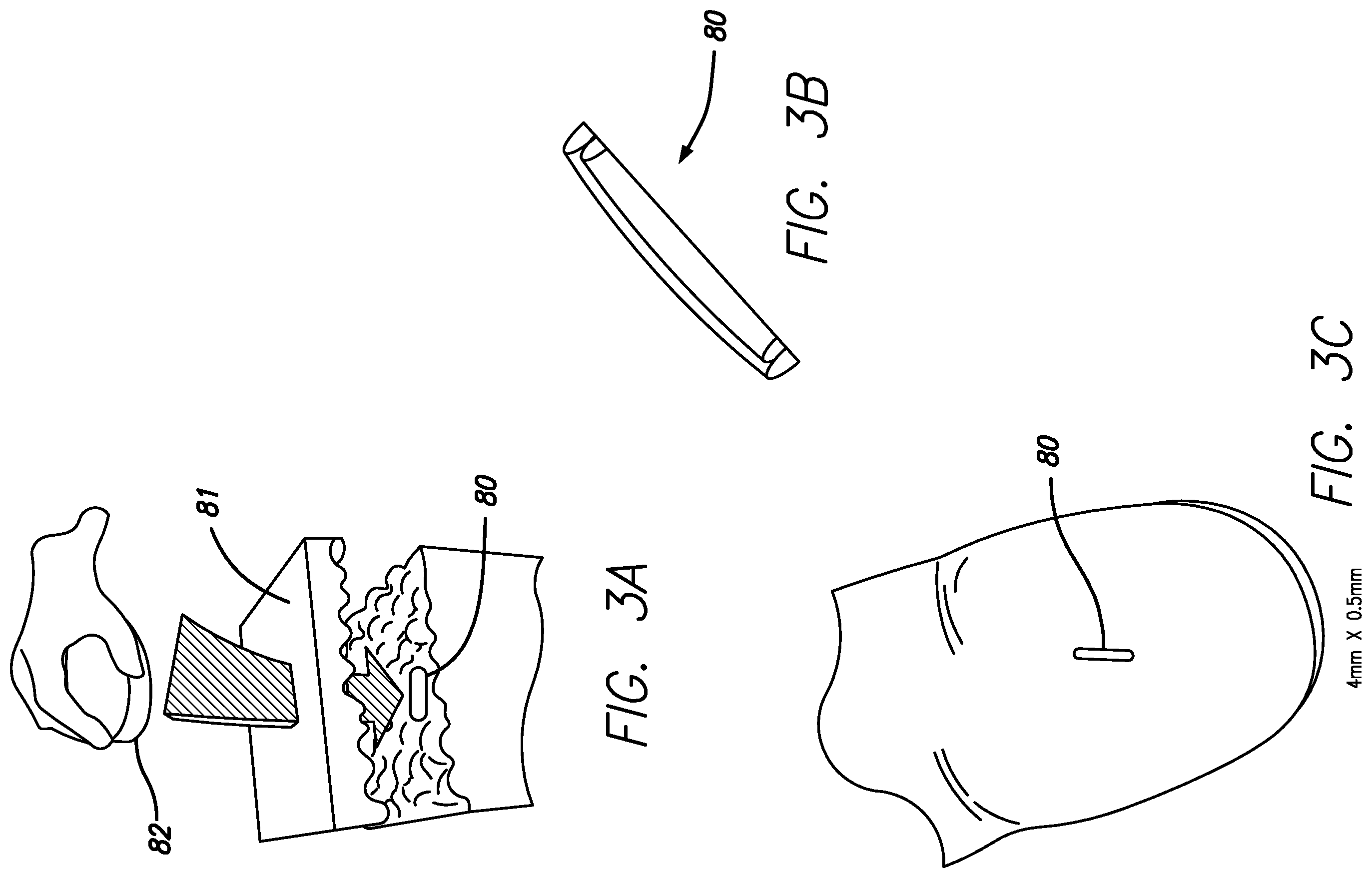 Patent US12396662 Figure 4 – Glucose sensor system
