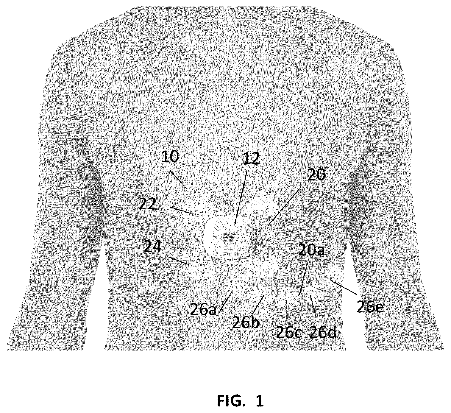 Patent US12396671 Figure 1 – ECG monitor device with electrode pad