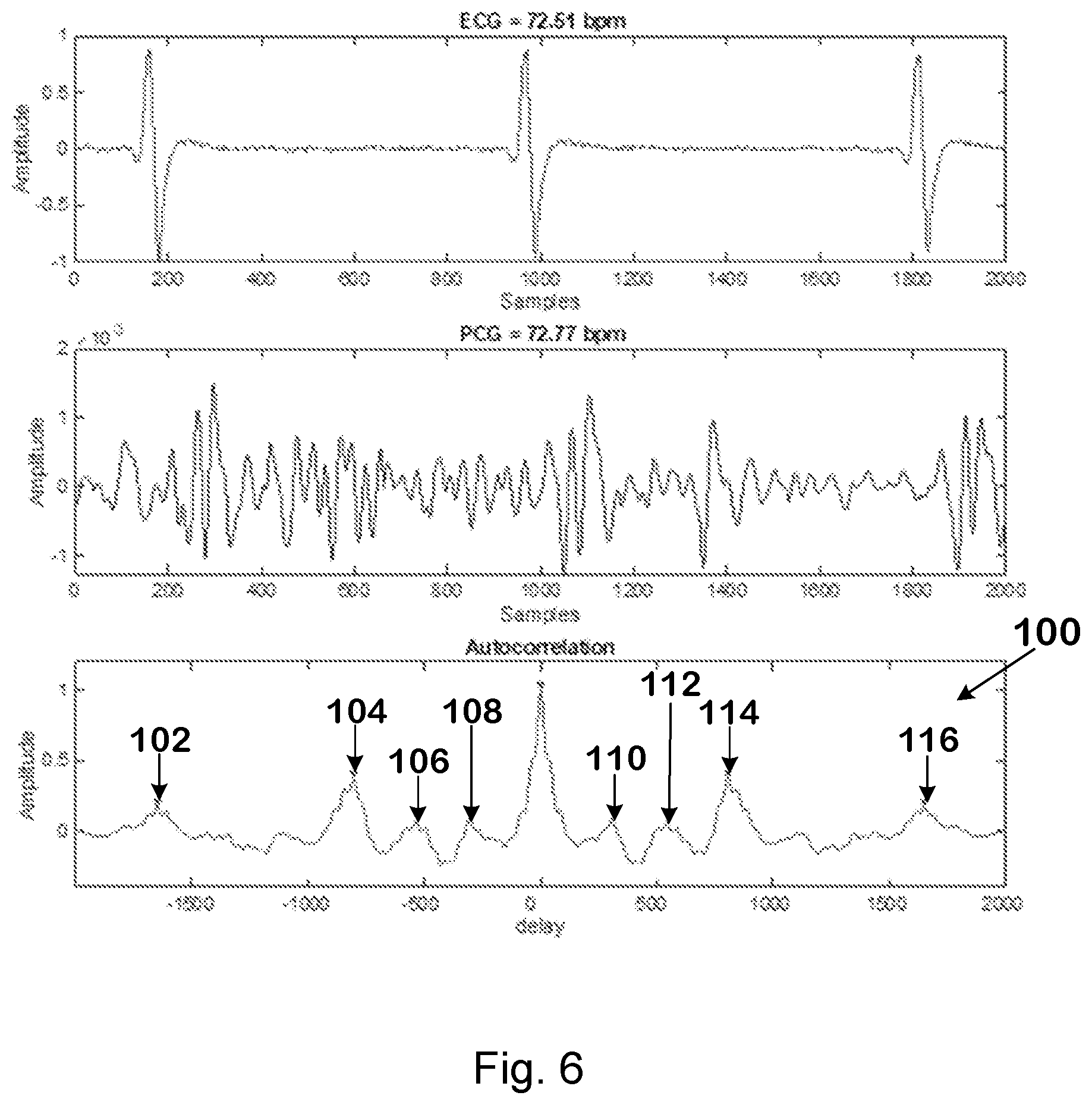 Patent US12396672 Figure 4 – On-ear detection