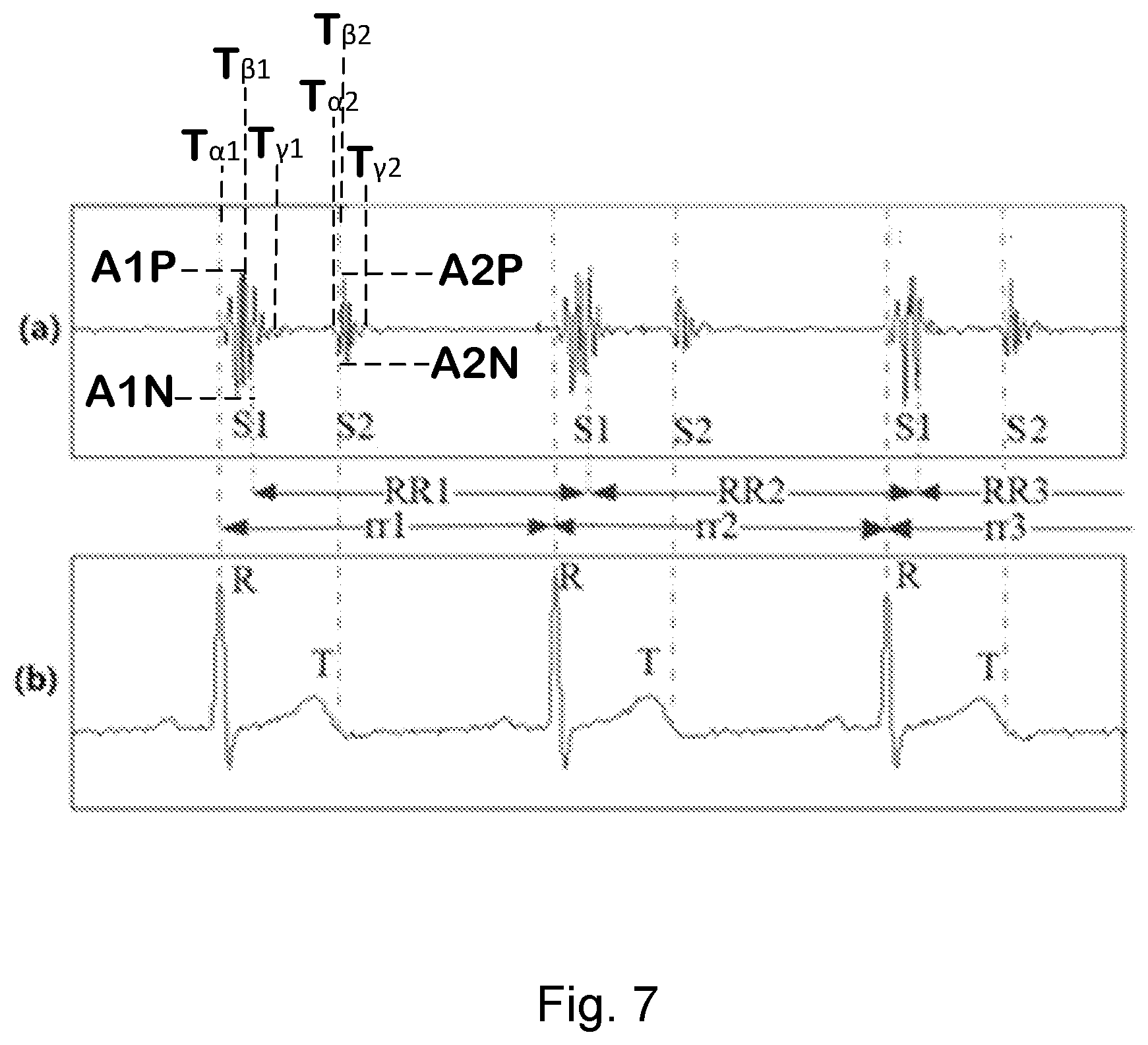 Patent US12396672 Figure 5 – On-ear detection