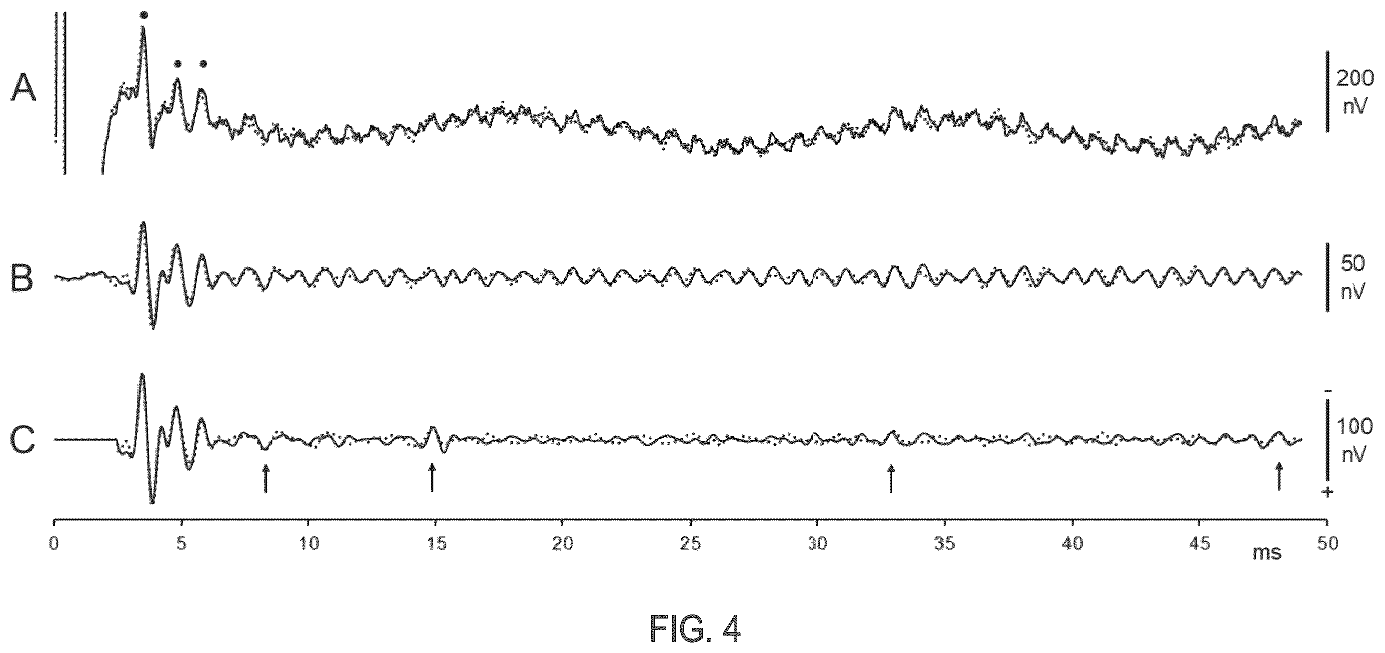 Patent US12396673 Figure 3 – Systems and methods for differentiating stimulus-evoked events from noise by analysis of two time series