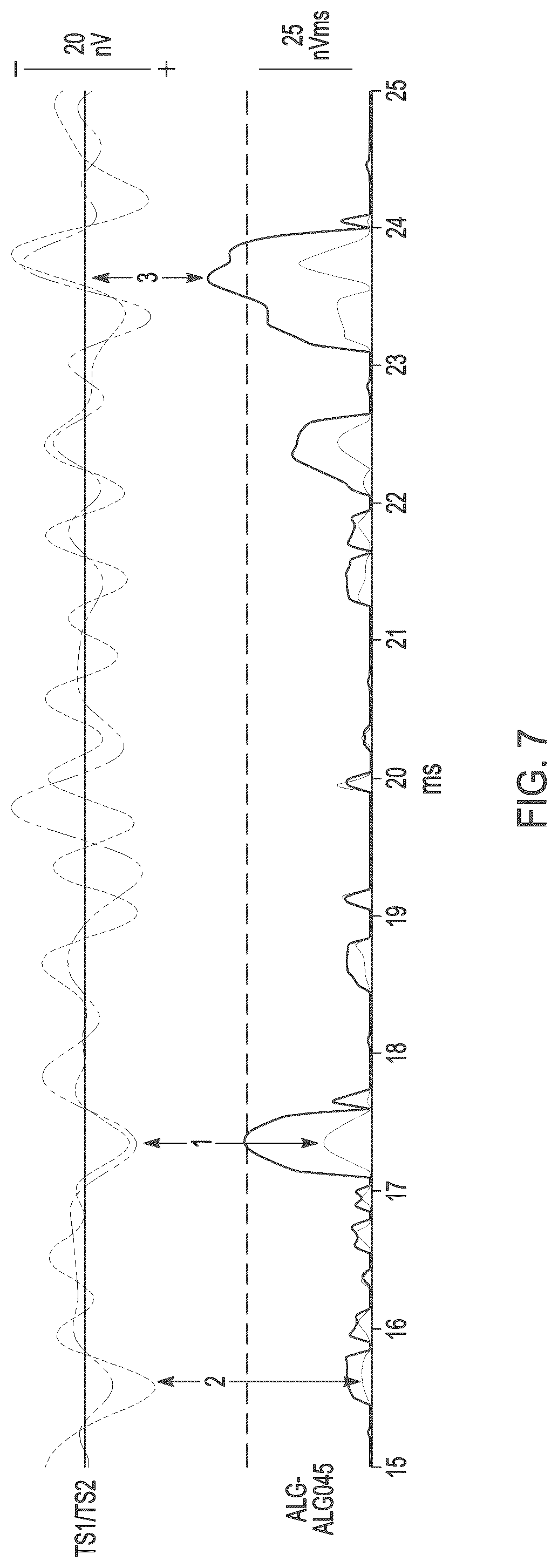 Patent US12396673 Figure 6 – Systems and methods for differentiating stimulus-evoked events from noise by analysis of two time series