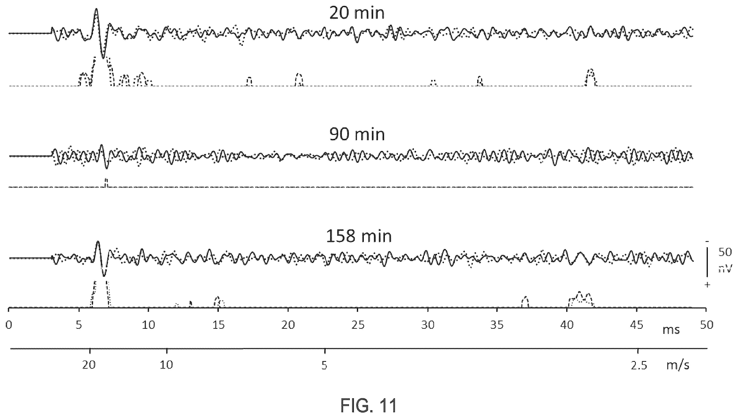 Patent US12396673 Figure 10 – Systems and methods for differentiating stimulus-evoked events from noise by analysis of two time series