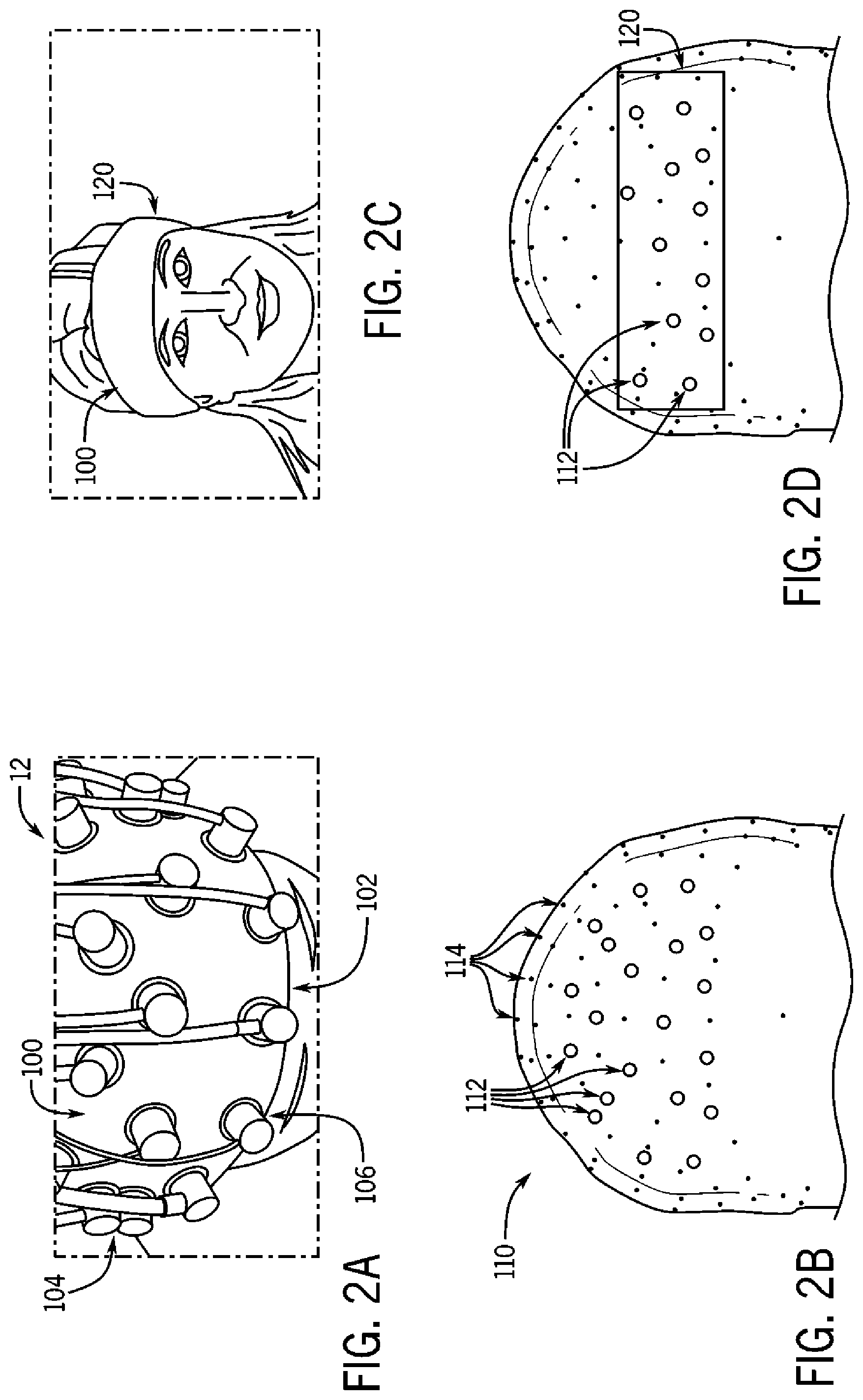 Patent US12396674 Figure 2 – System and method for detecting acute brain function impairment