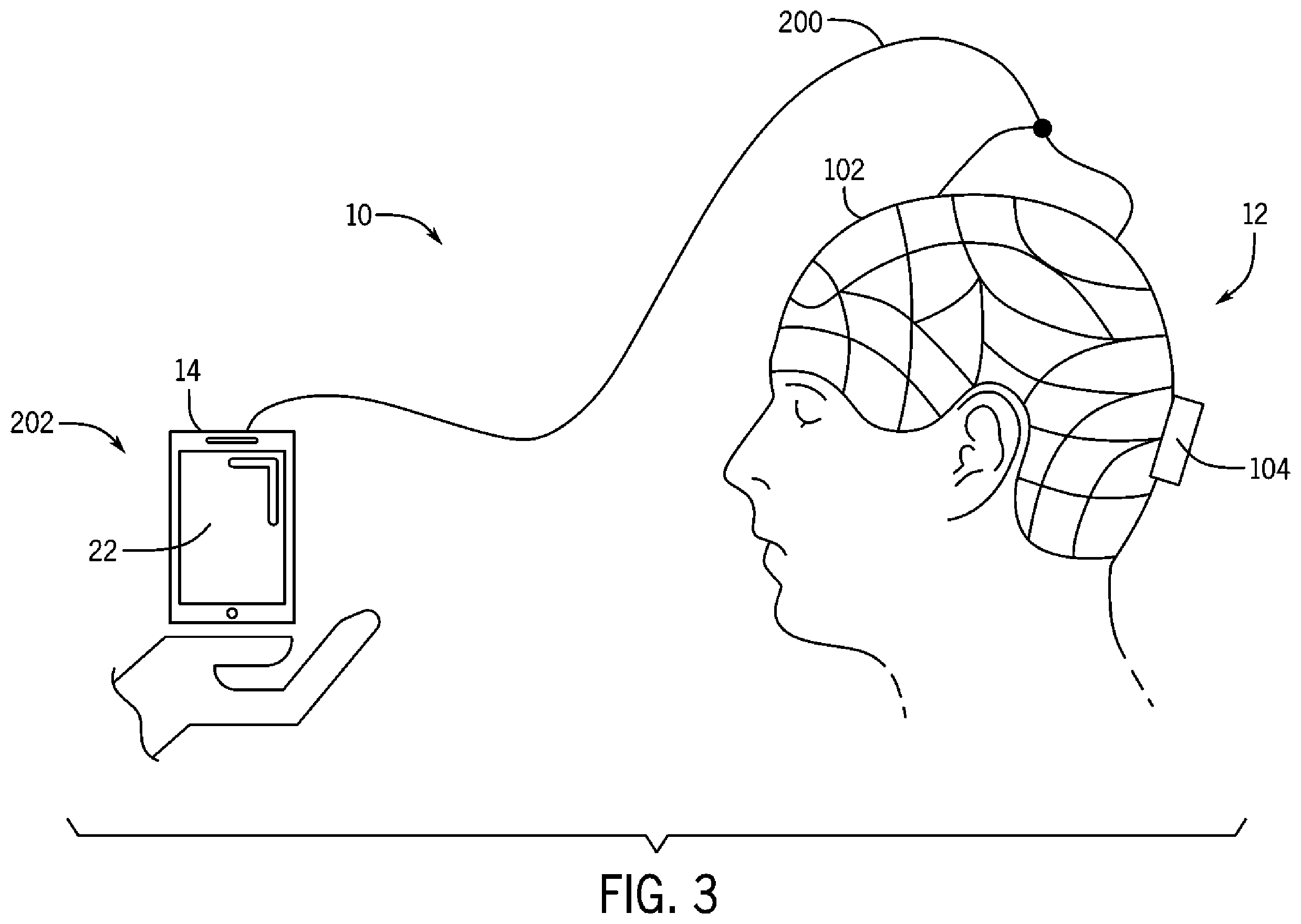 Patent US12396674 Figure 3 – System and method for detecting acute brain function impairment
