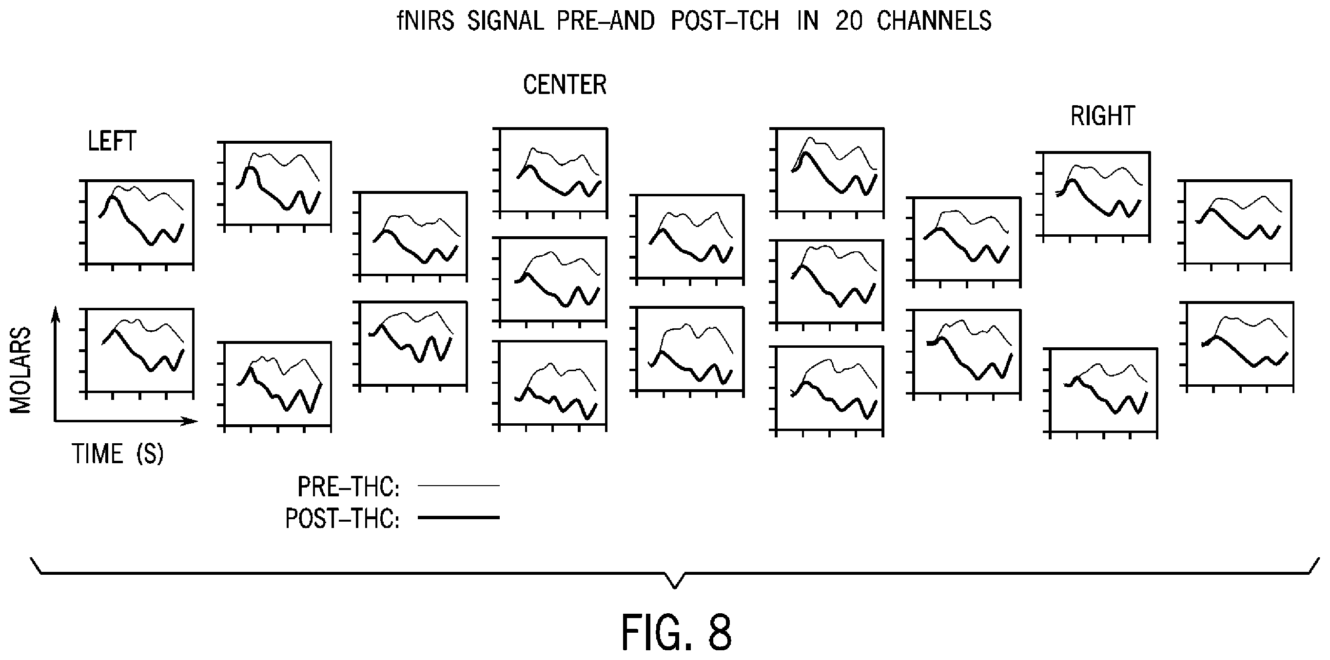 Patent US12396674 Figure 8 – System and method for detecting acute brain function impairment
