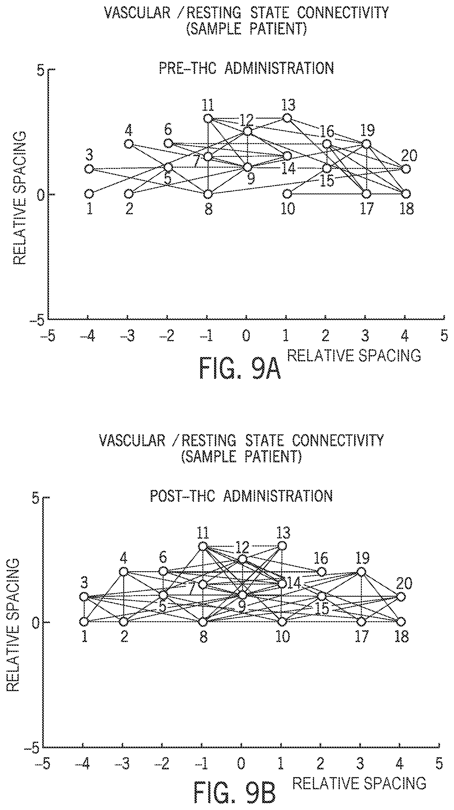 Patent US12396674 Figure 9 – System and method for detecting acute brain function impairment