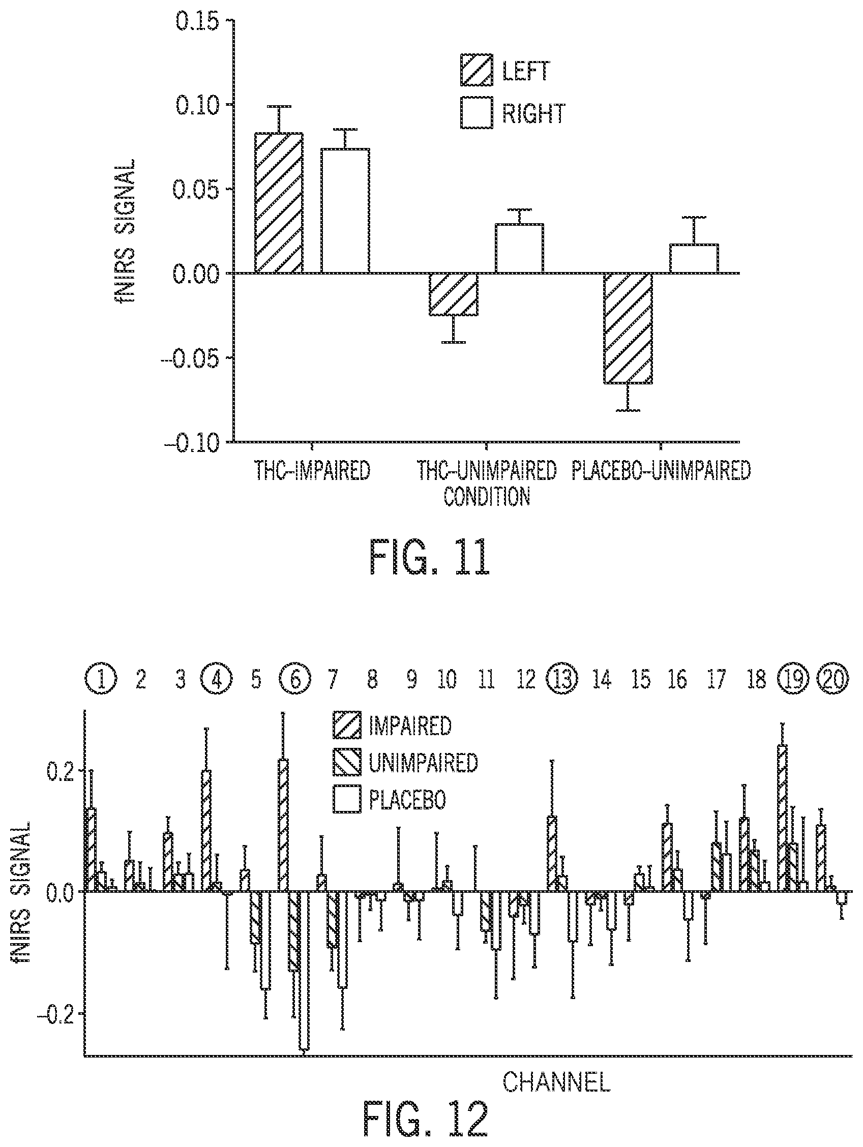 Patent US12396674 Figure 11 – System and method for detecting acute brain function impairment