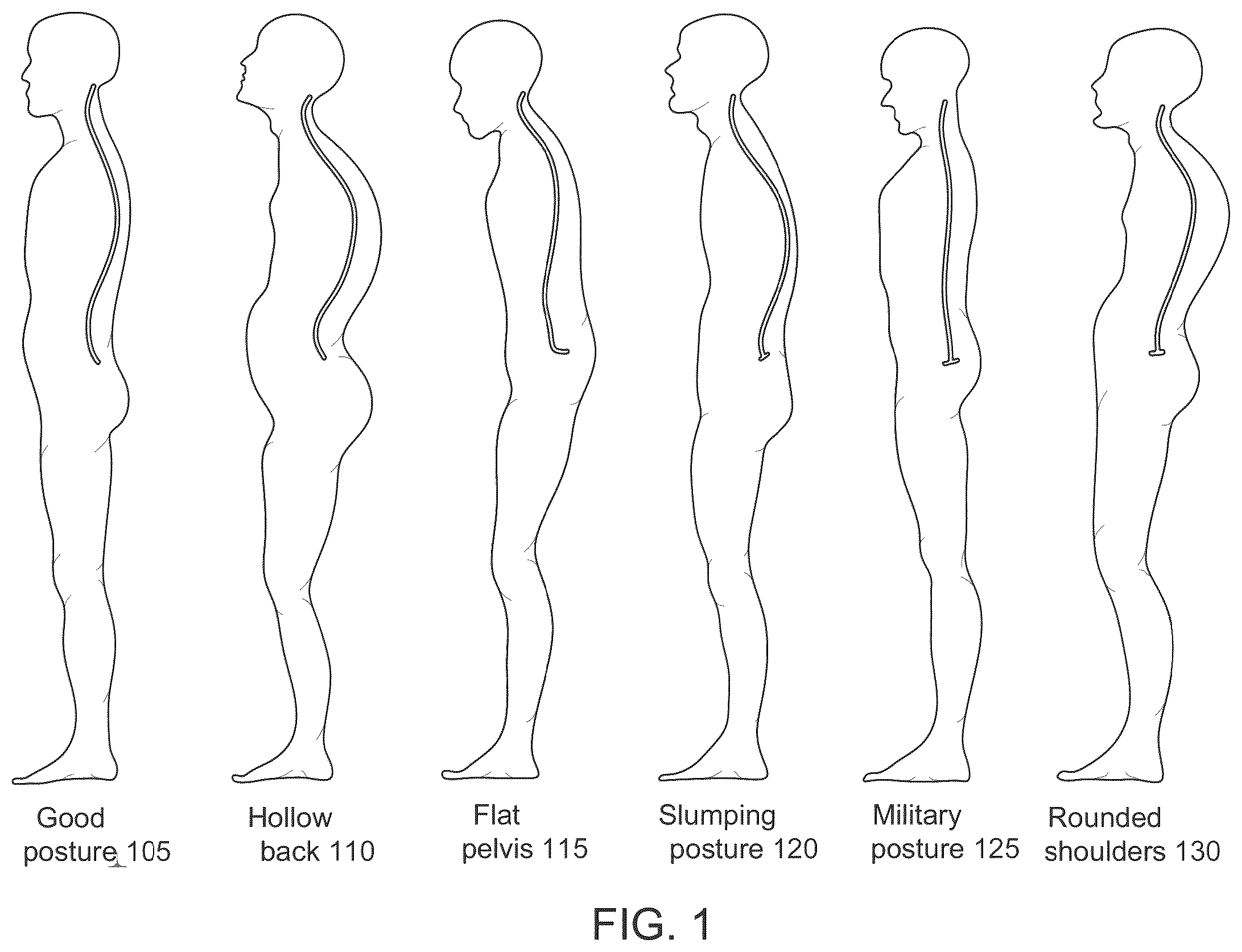 Patent US12396676 Figure 1 – System and method for automated diagnosis of musculoskeletal and neurological disorders