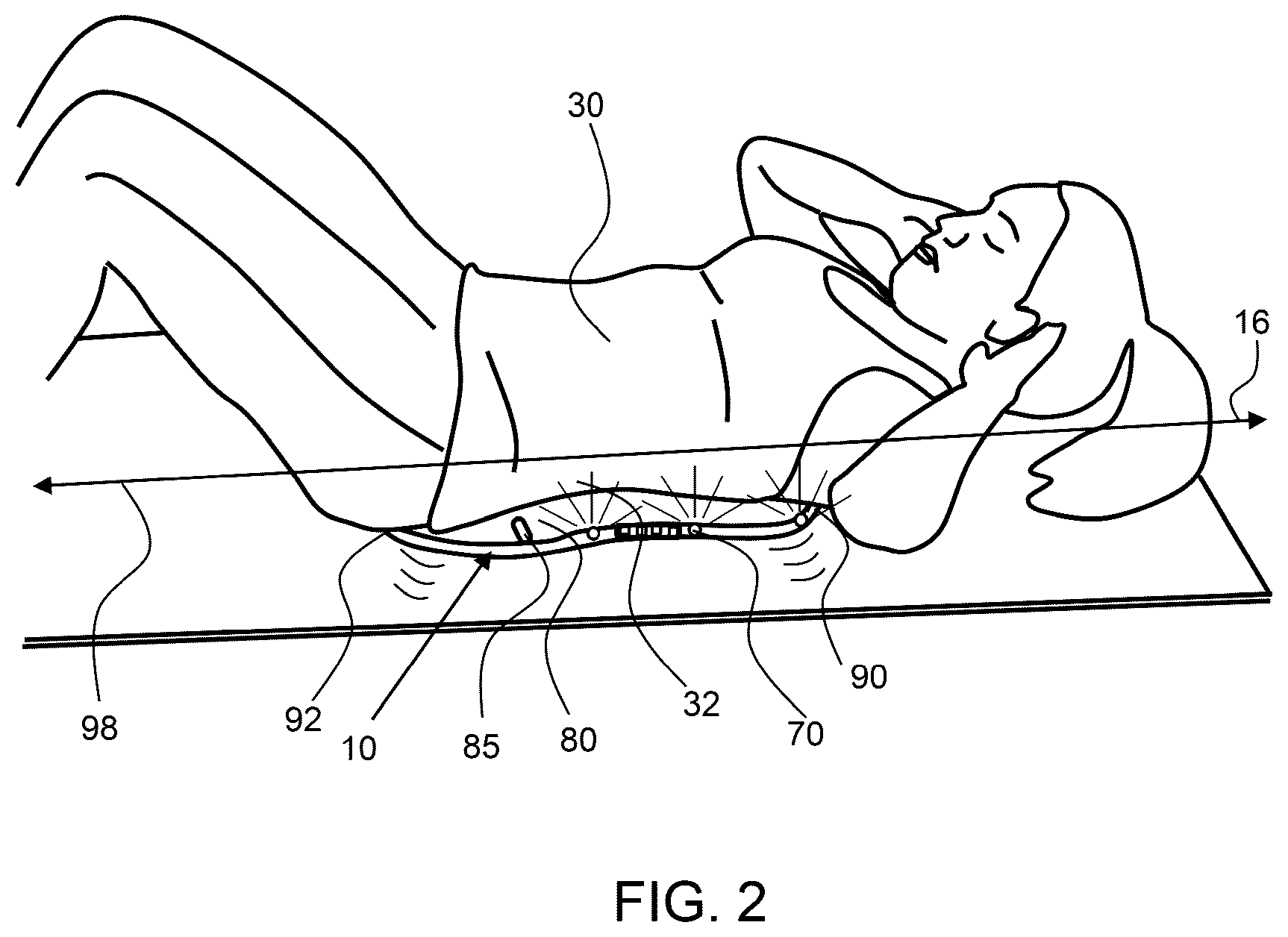 Patent US12396678 Figure 2 – Postural awareness and exercise device