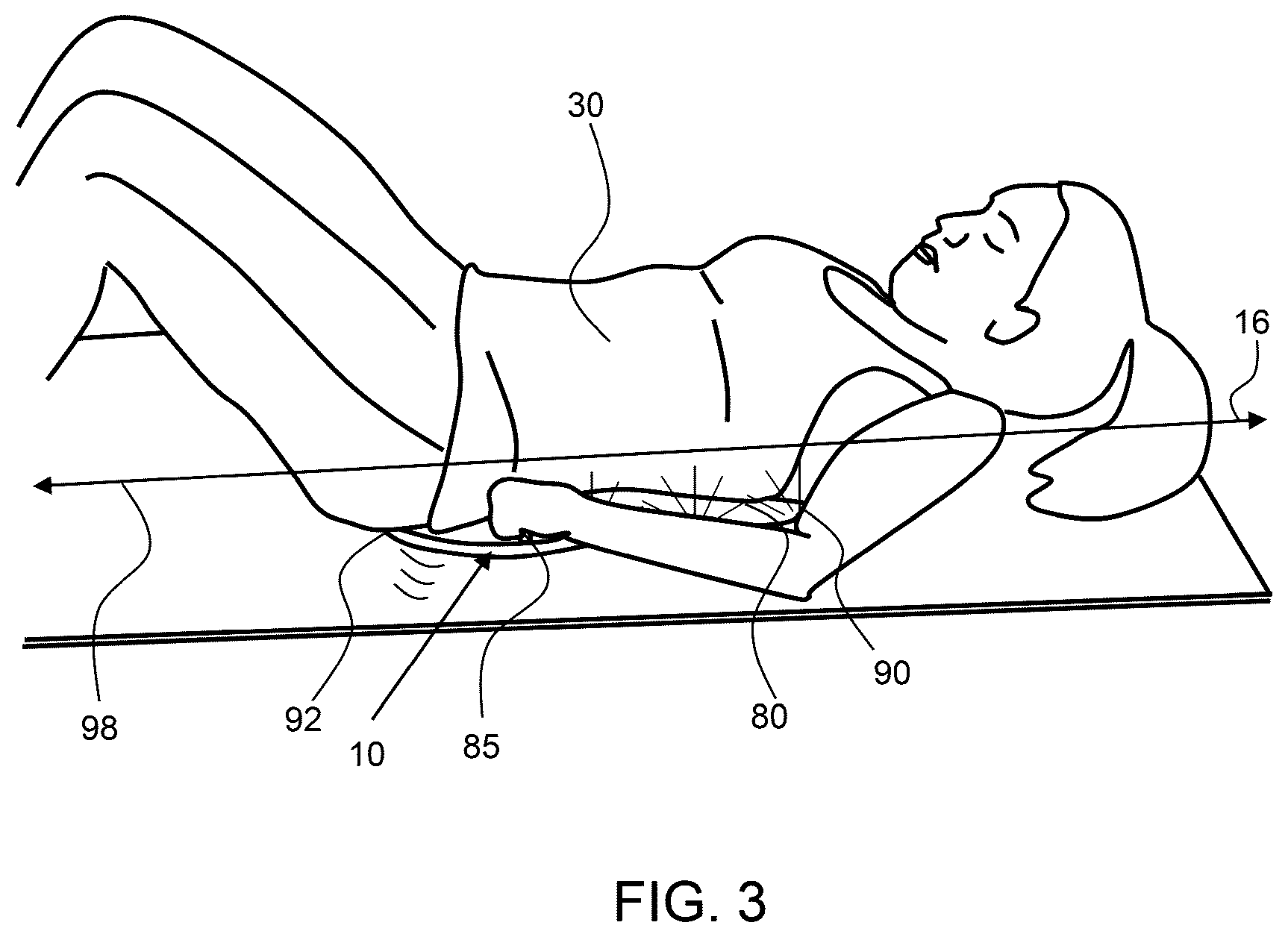 Patent US12396678 Figure 3 – Postural awareness and exercise device