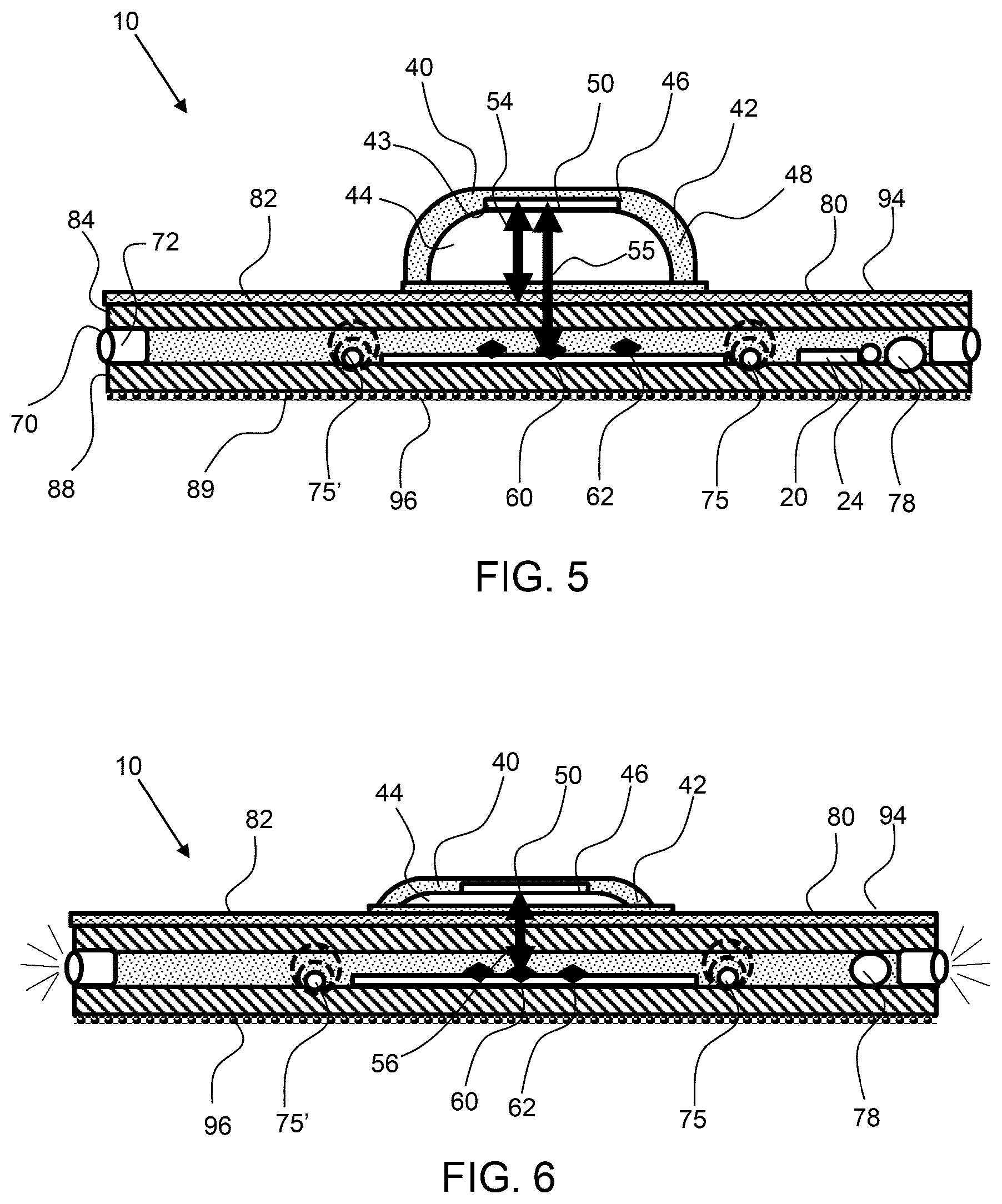 Patent US12396678 Figure 5 – Postural awareness and exercise device