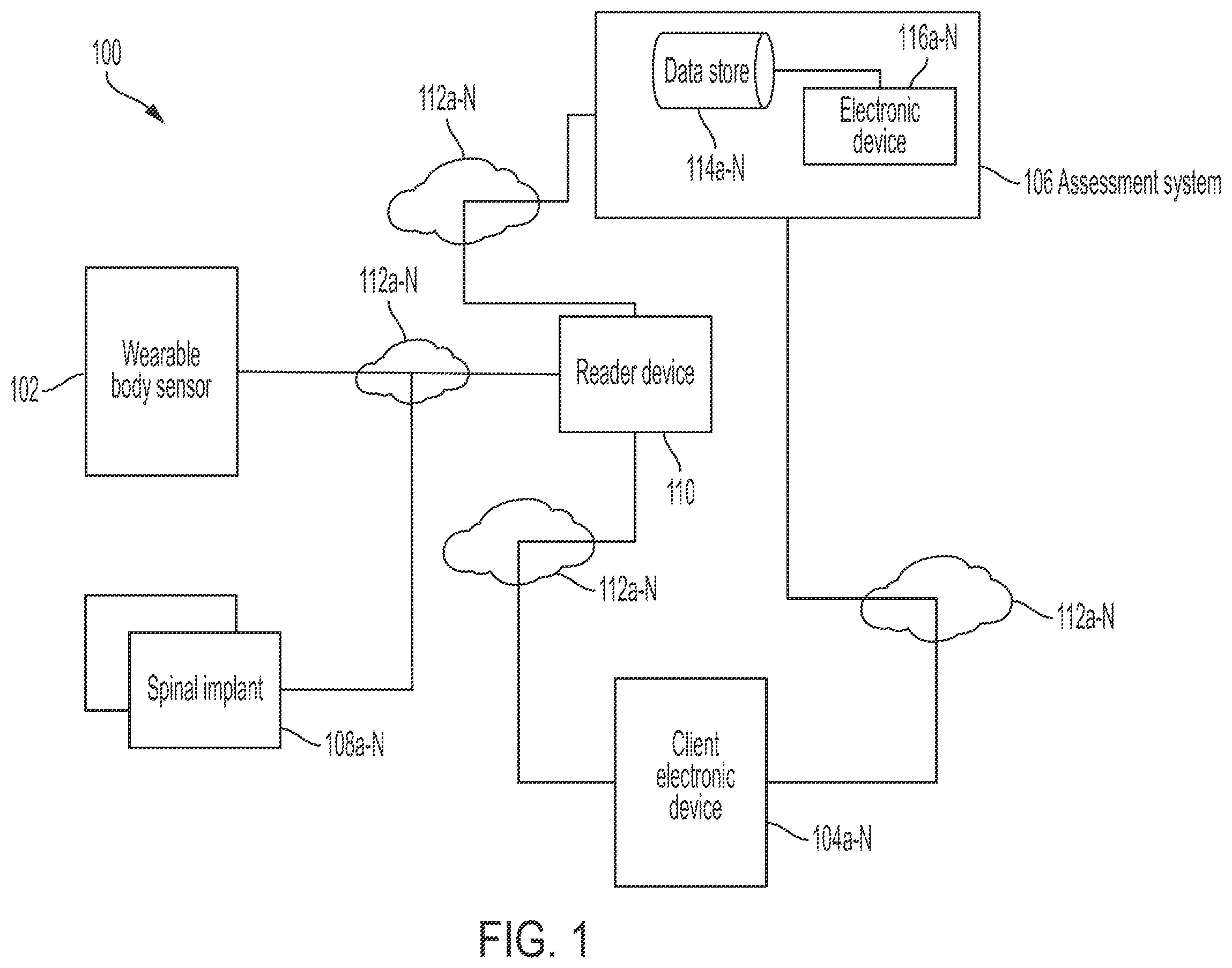Patent US12396679 Figure 1 – System and method for post-operative assessment of spinal motion and implant-based strain correlation