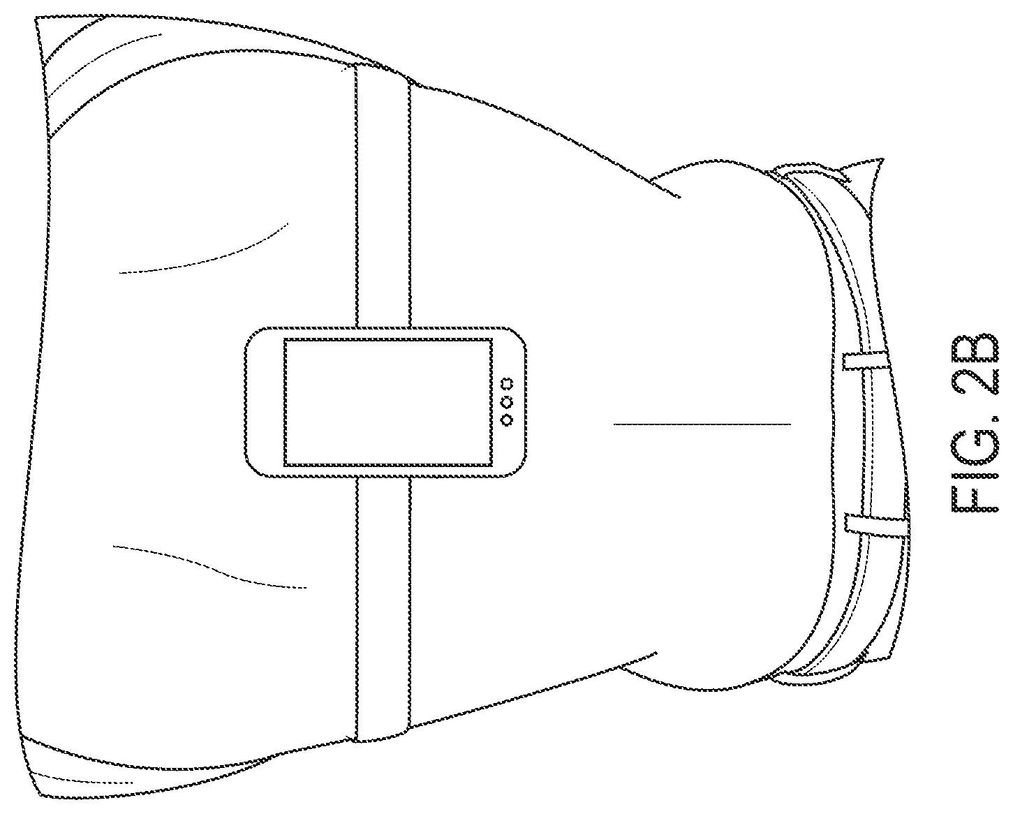 Patent US12396679 Figure 3 – System and method for post-operative assessment of spinal motion and implant-based strain correlation