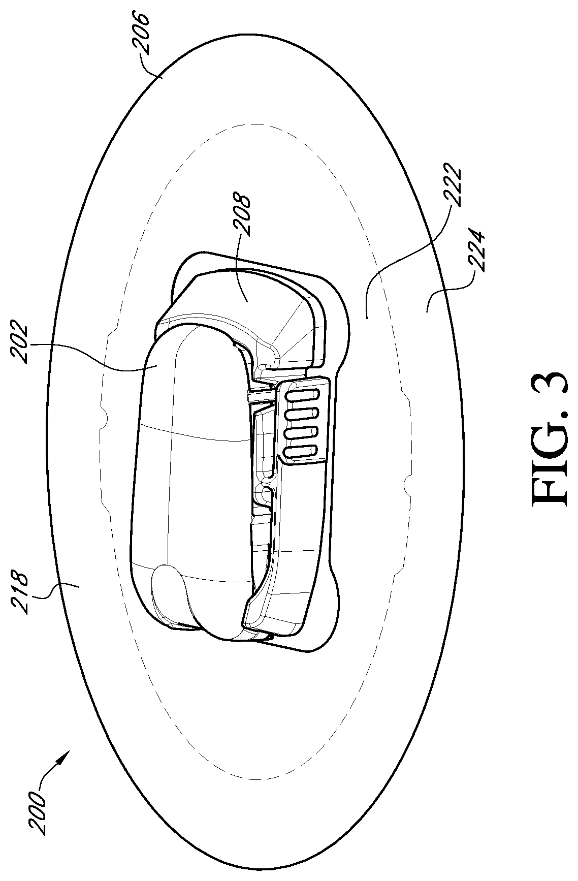 Patent US12396682 Figure 3 – Systems and methods for securing a continuous analyte sensor to a host