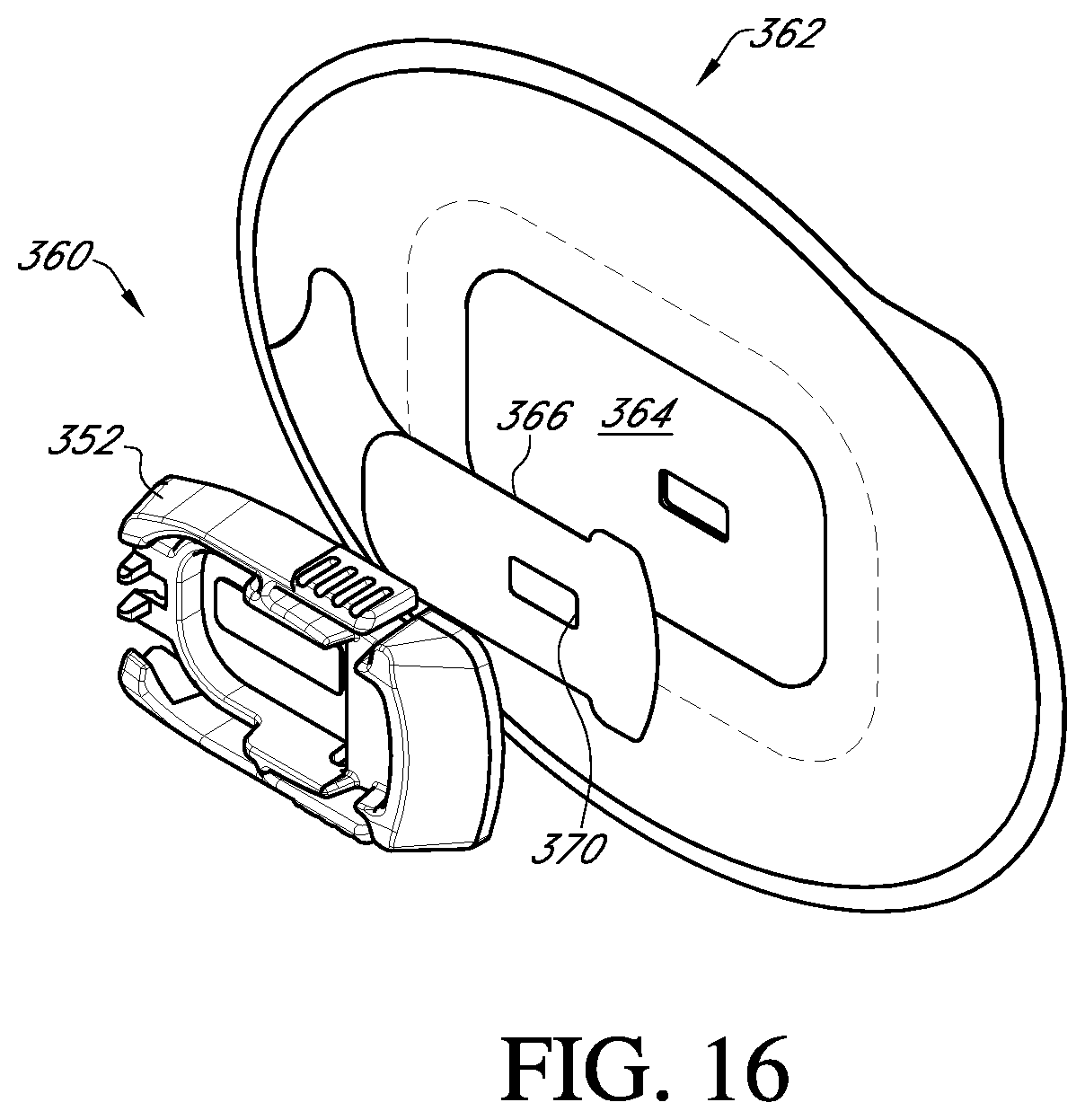 Patent US12396682 Figure 17 – Systems and methods for securing a continuous analyte sensor to a host