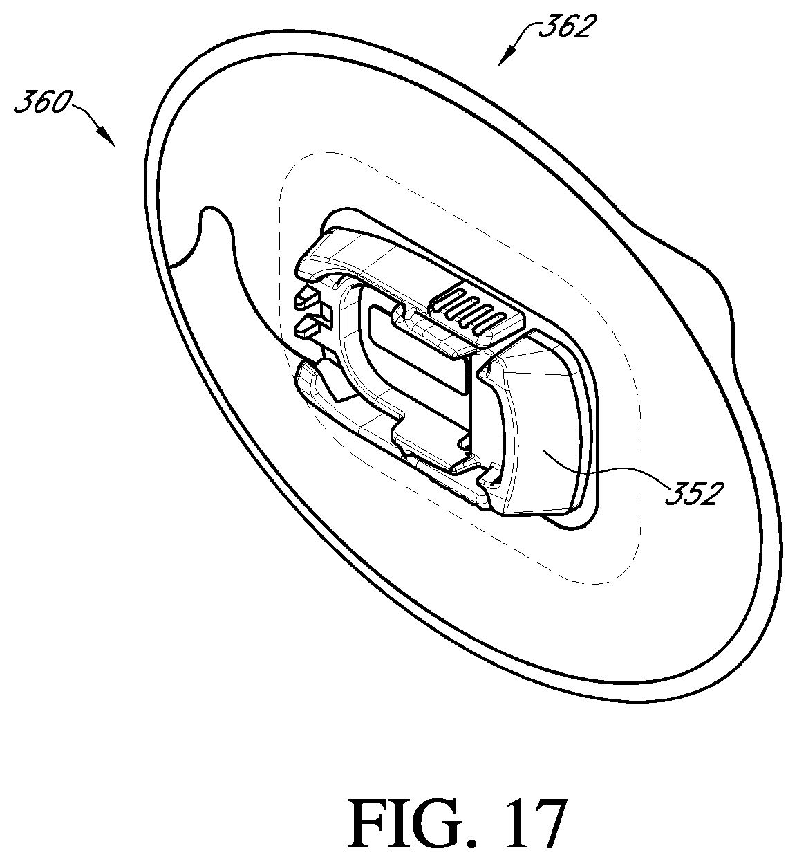 Patent US12396682 Figure 18 – Systems and methods for securing a continuous analyte sensor to a host