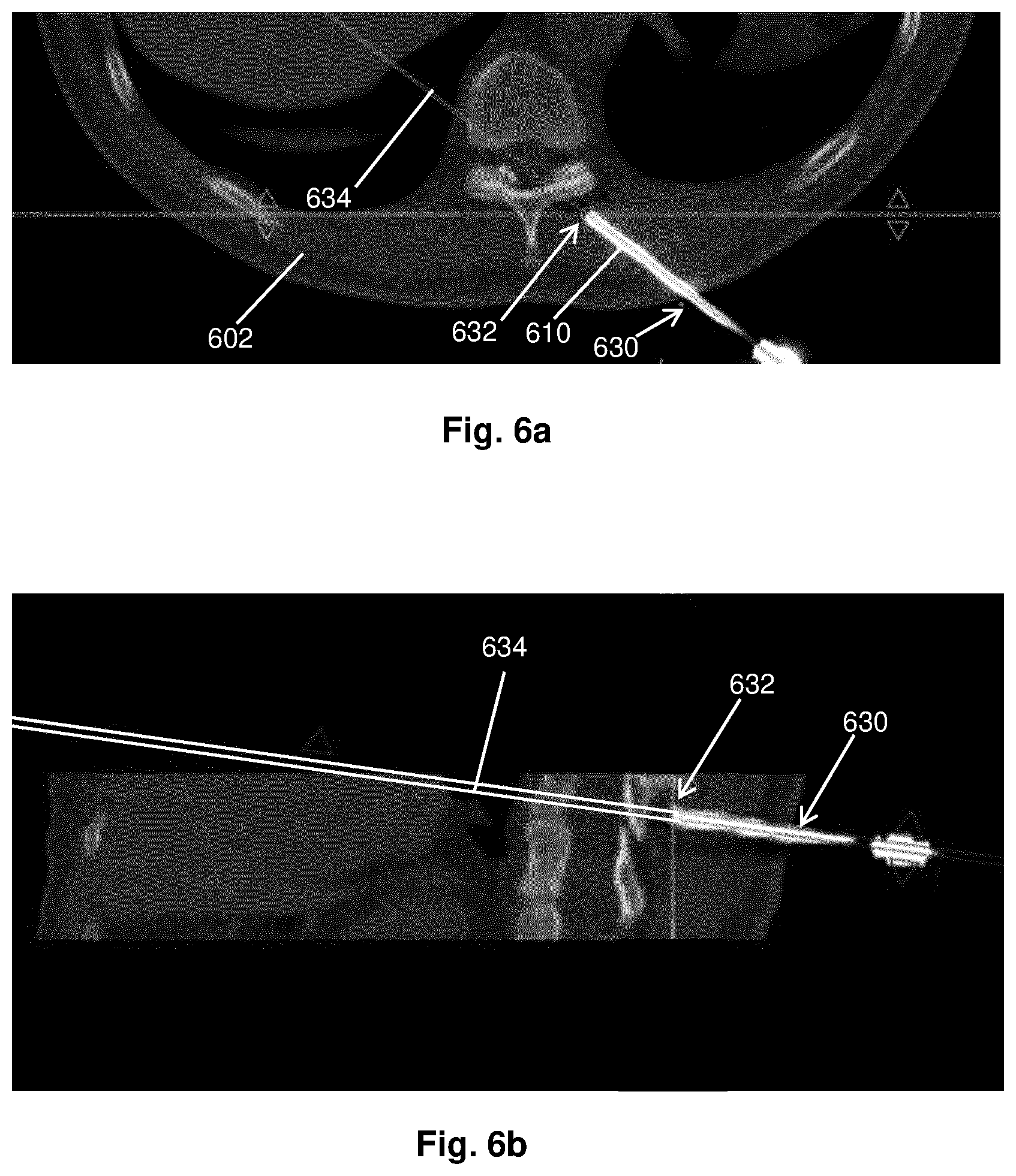 Patent US12396689 Figure 4 – Determining needle position