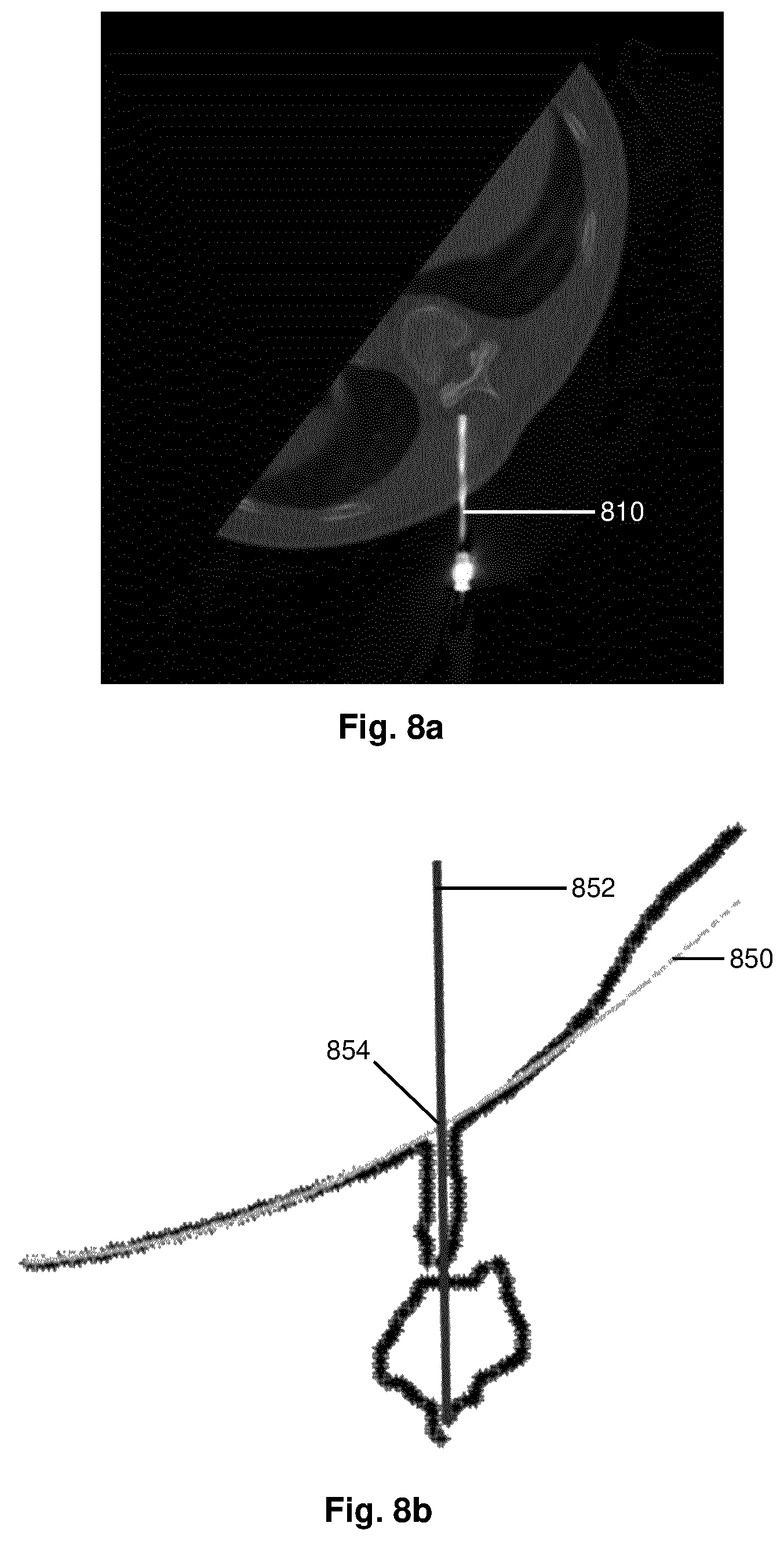 Patent US12396689 Figure 6 – Determining needle position