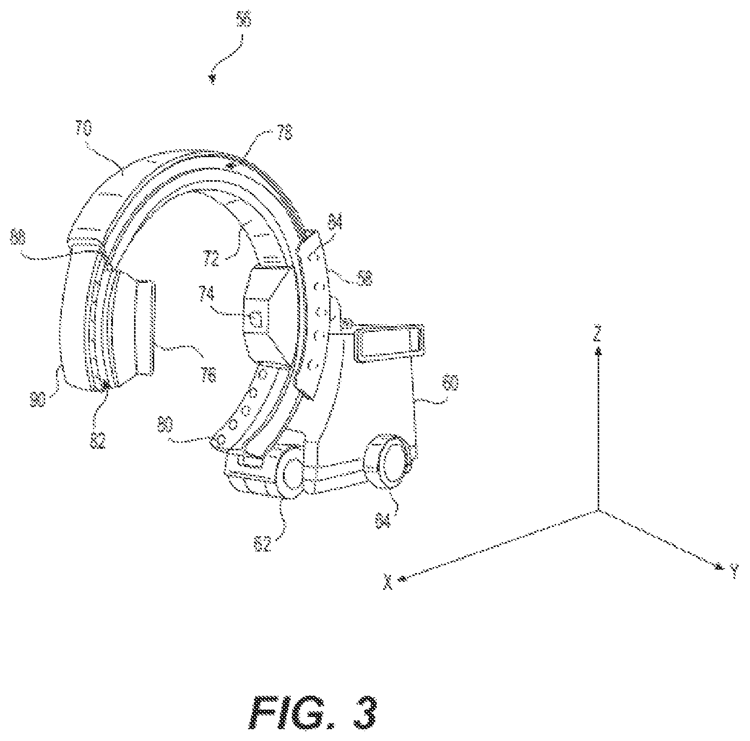 Patent US12396692 Figure 3 – Compound curve cable chain