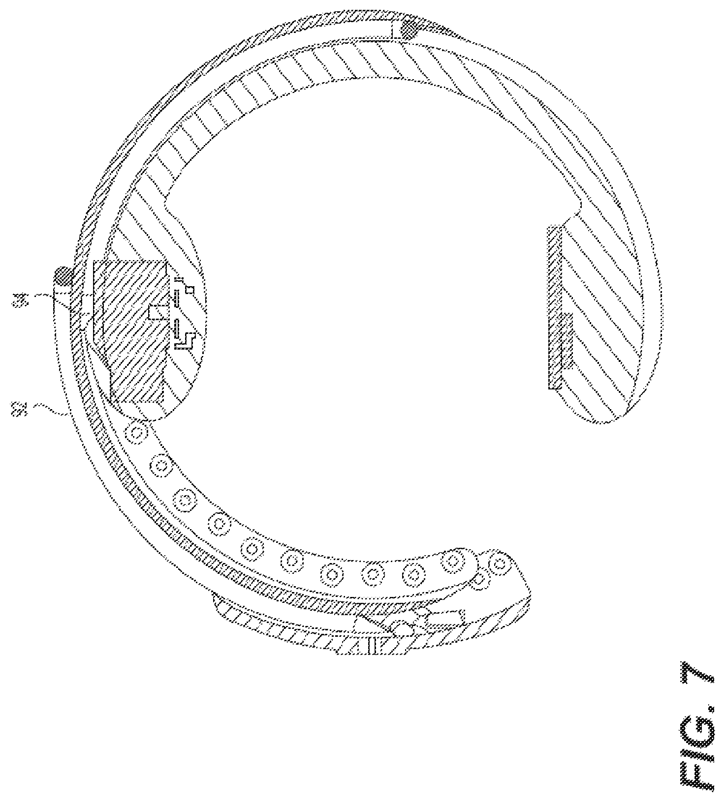 Patent US12396692 Figure 7 – Compound curve cable chain